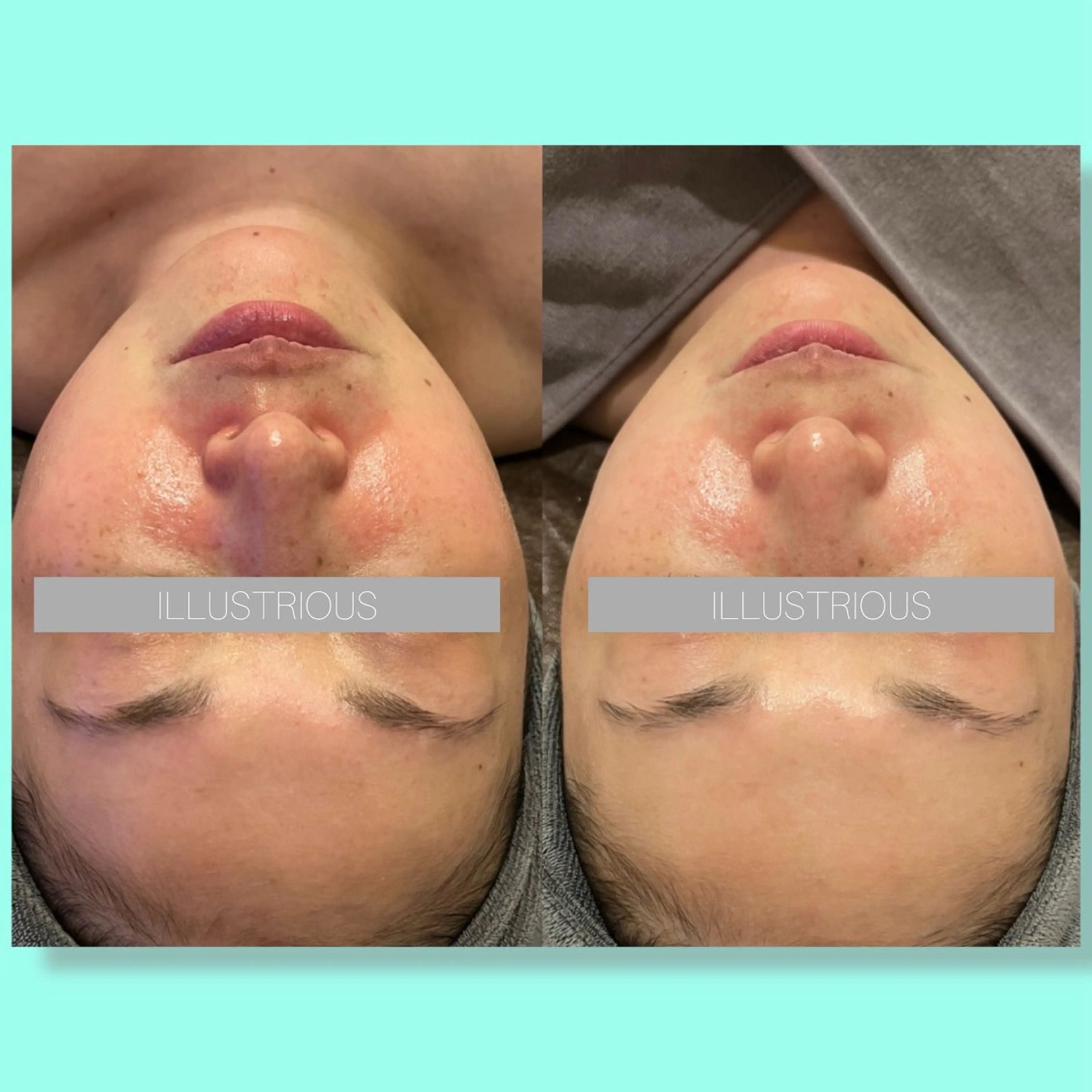 ☆痩身/小顔☆ コルギのエステ・リラクイメージ