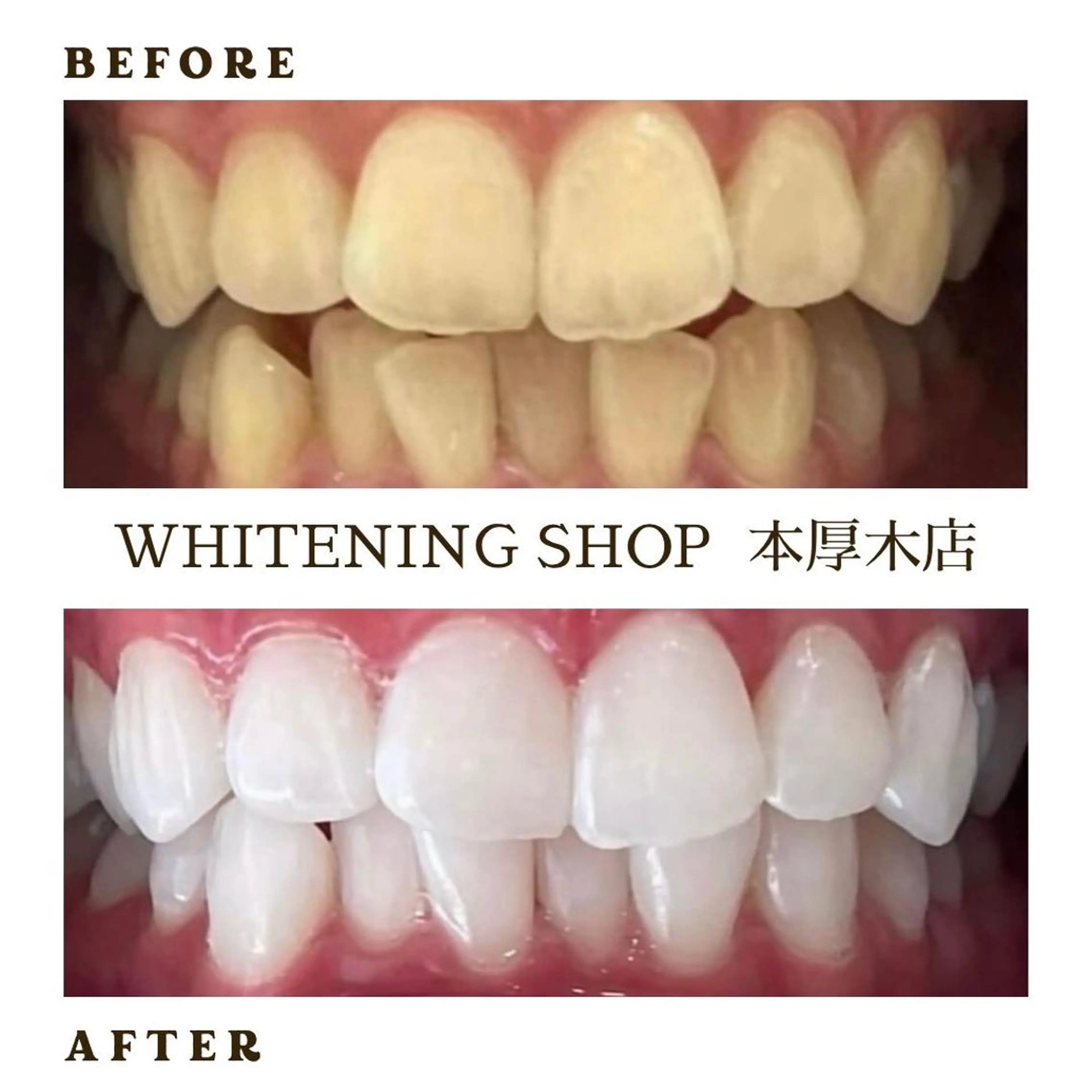 メンズ その他 ホワイトニング ショップ本厚木のその他イメージ