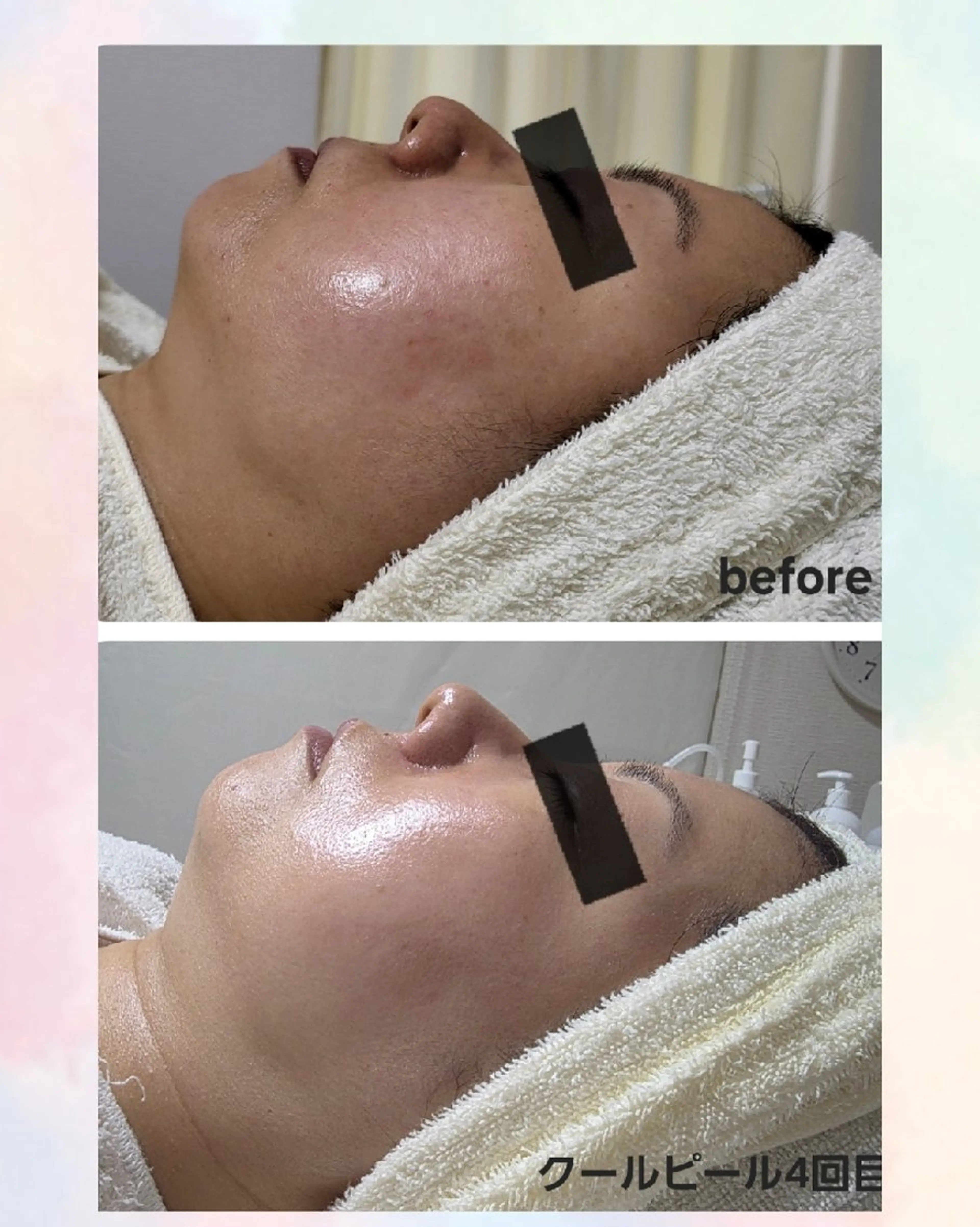 エステ ニキビケア&ニキビ跡 レゾン京橋店 のエステ・リラクイメージ