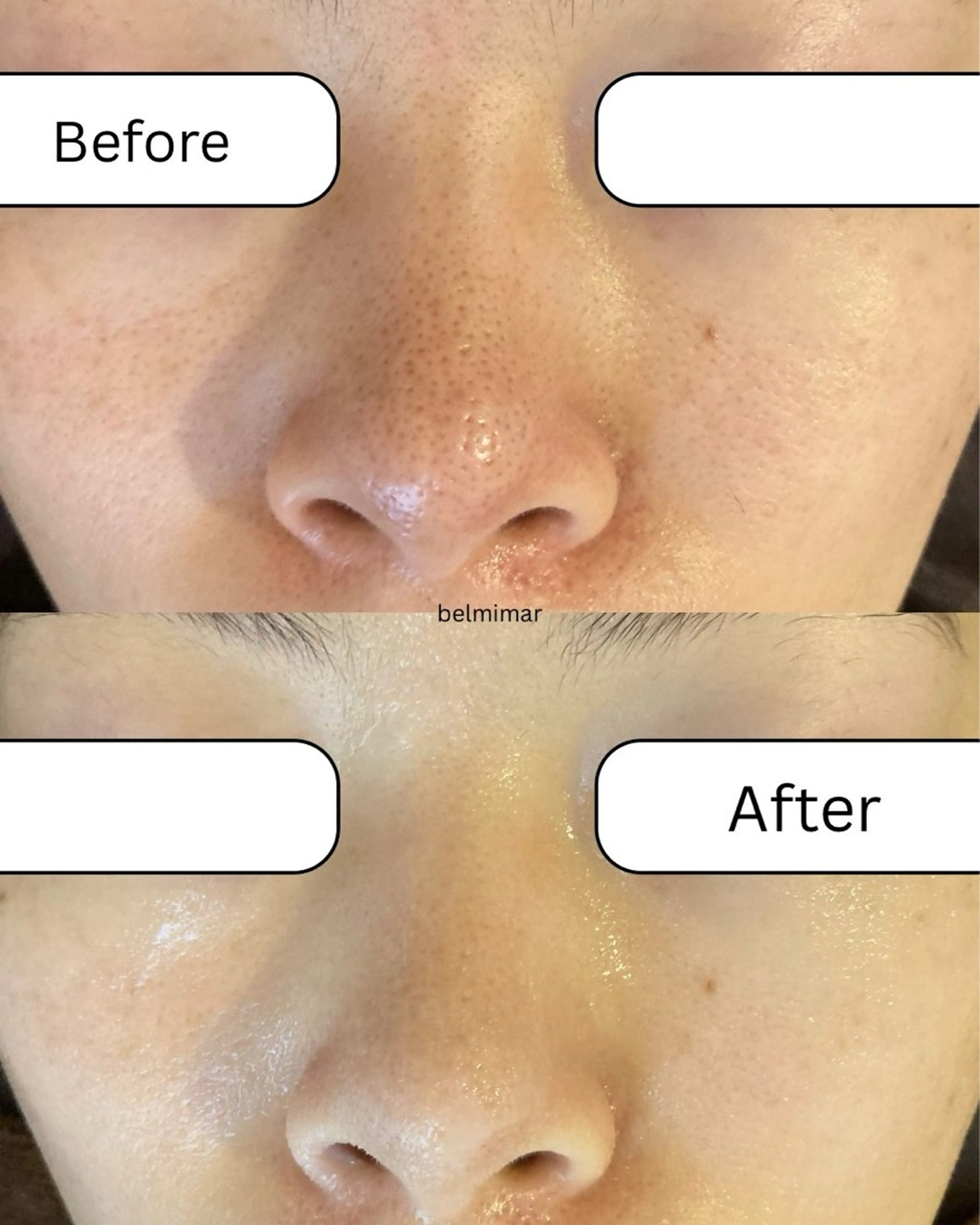 南森町・肌質改善 BELMIMARのエステ・リラクイメージ