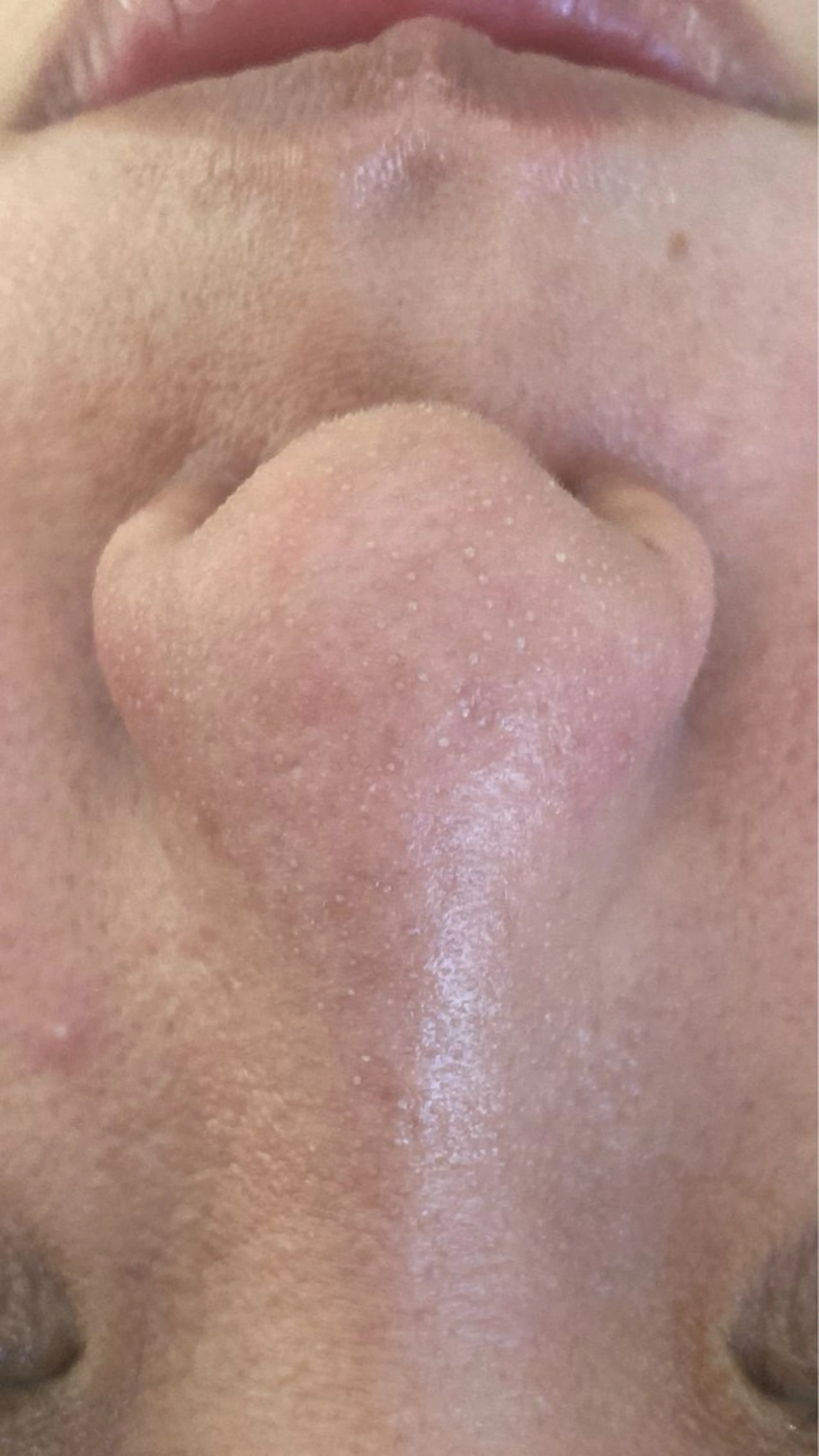 エステ プライベートサロン 座間市/LOKAHIのエステ・リラクイメージ