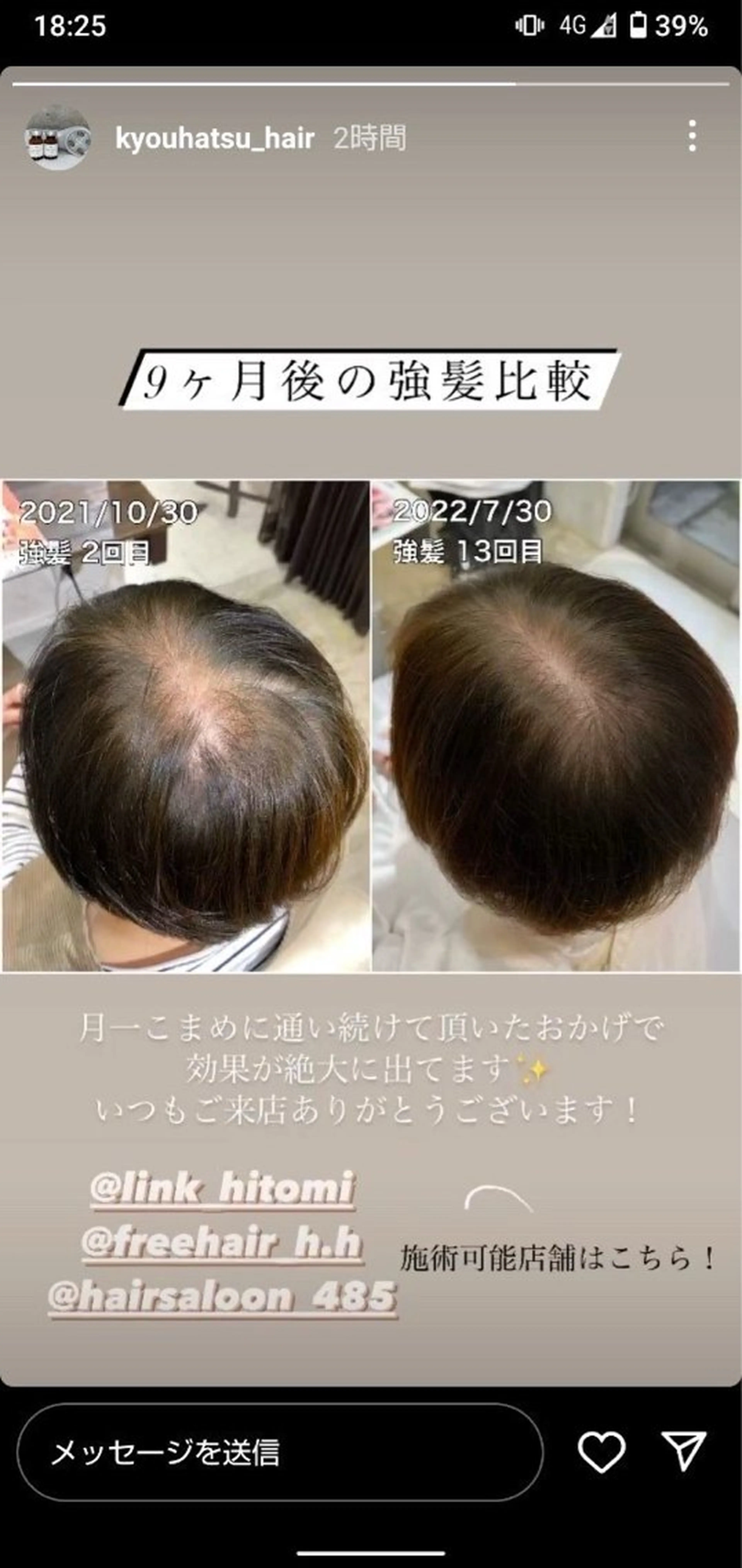 トリートメント ヘッドスパ 痩身・脱毛・美髪ケア 【GLYCINE】のエステ・リラクイメージ