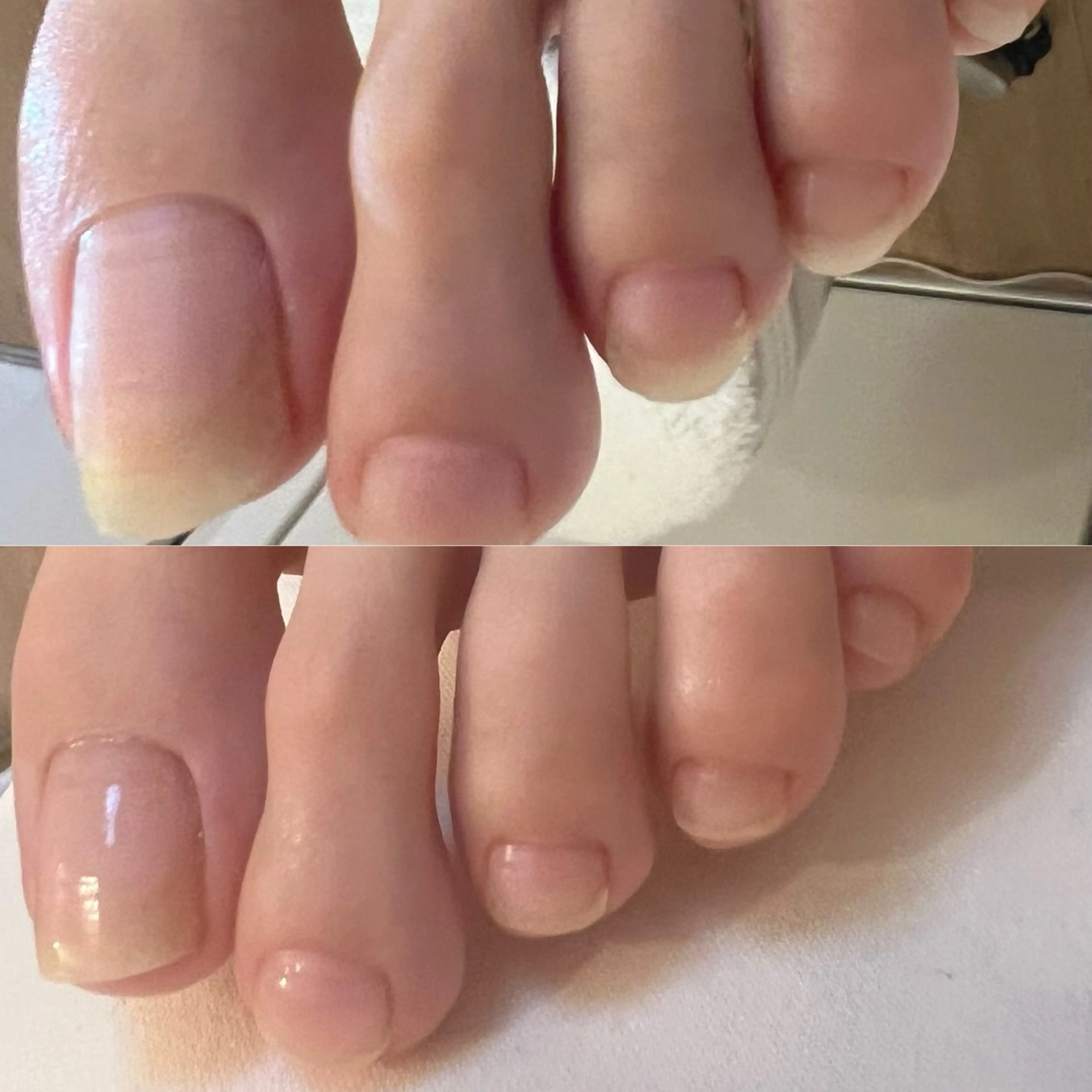 ハンドネイル フットネイル ハンドケア TRUE CARE所属・ハーブピーリング/ 上本町/美肌/幹細胞のエステ・リラクイメージ