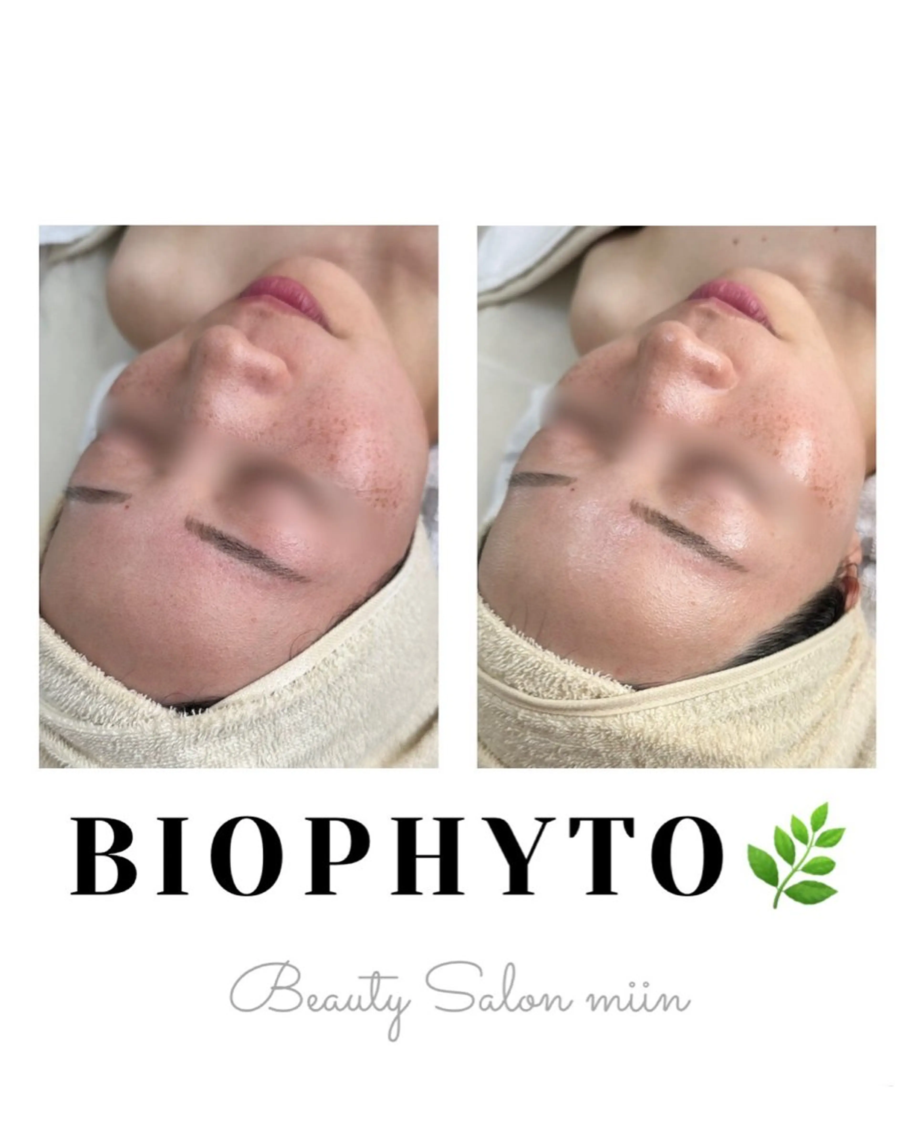 リラク 韓国肌管理 白玉肌管理®︎のエステ・リラクイメージ