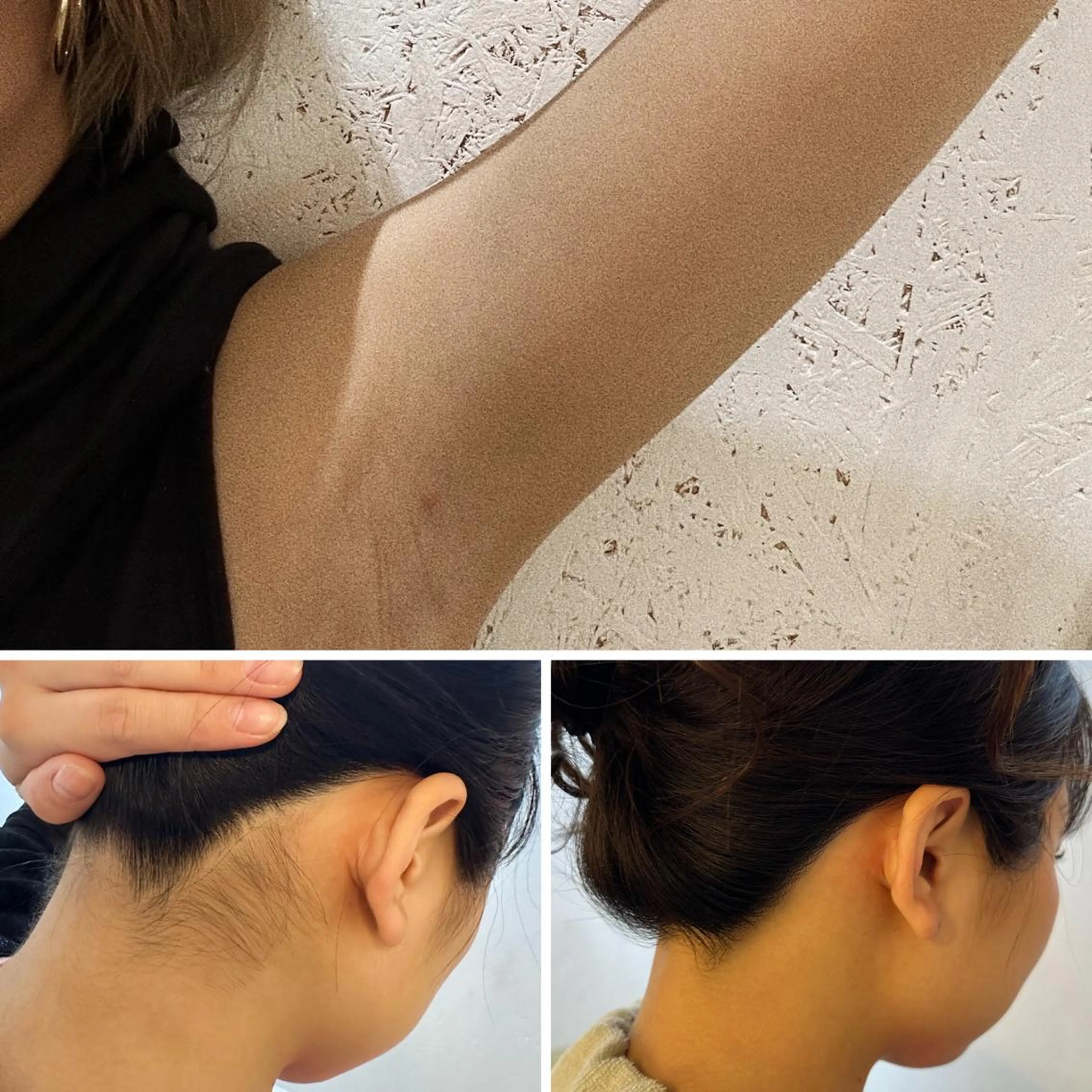 脱毛 うなじ脱毛/美肌脱毛 LABELのエステ・リラクイメージ