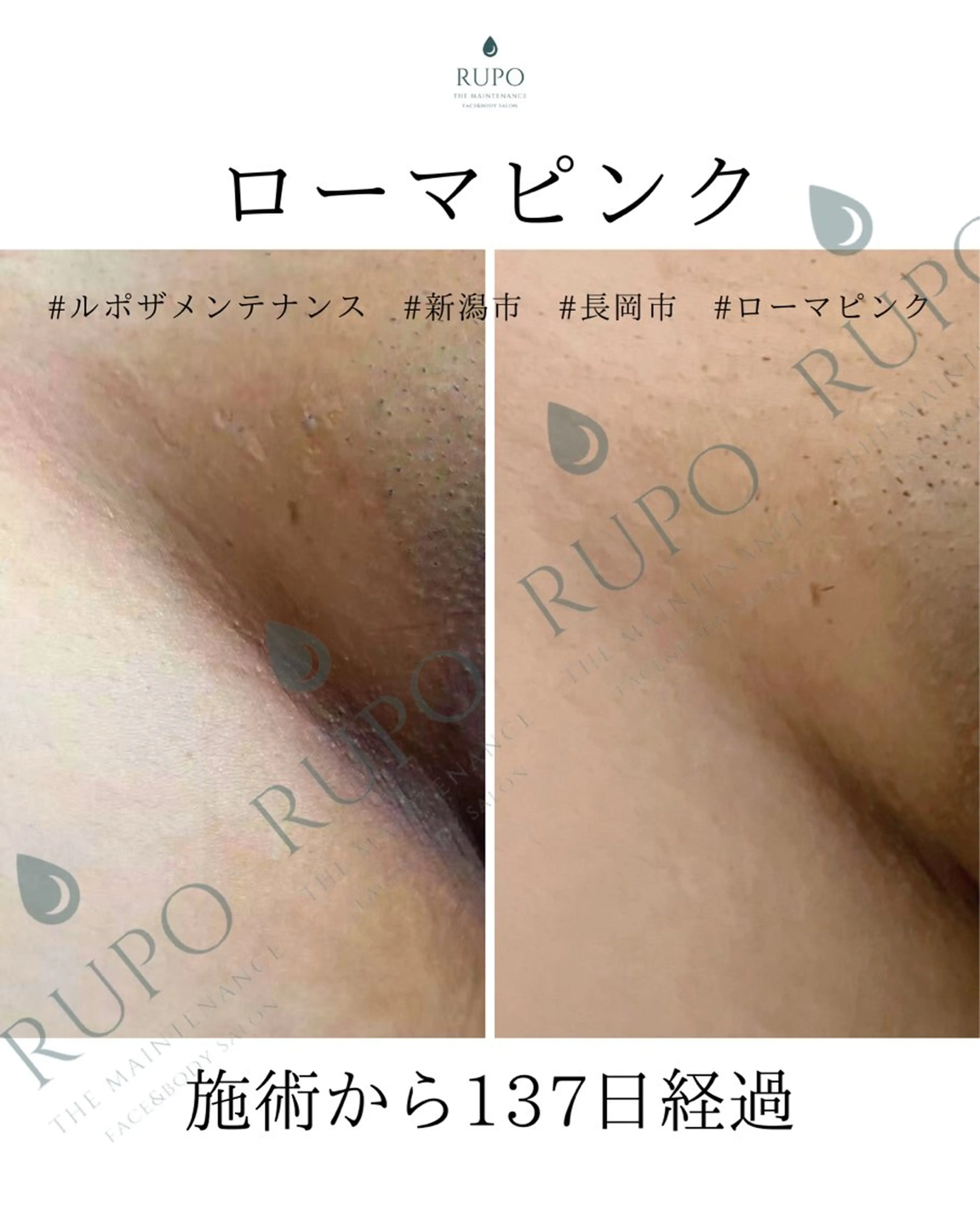 エステ RUPO THE MAINTENANCE新潟店【ローマピンク公式認定店/ララピール正規店/骨格小顔】所属・オーナー Nanjoのエステ・リラクイメージ