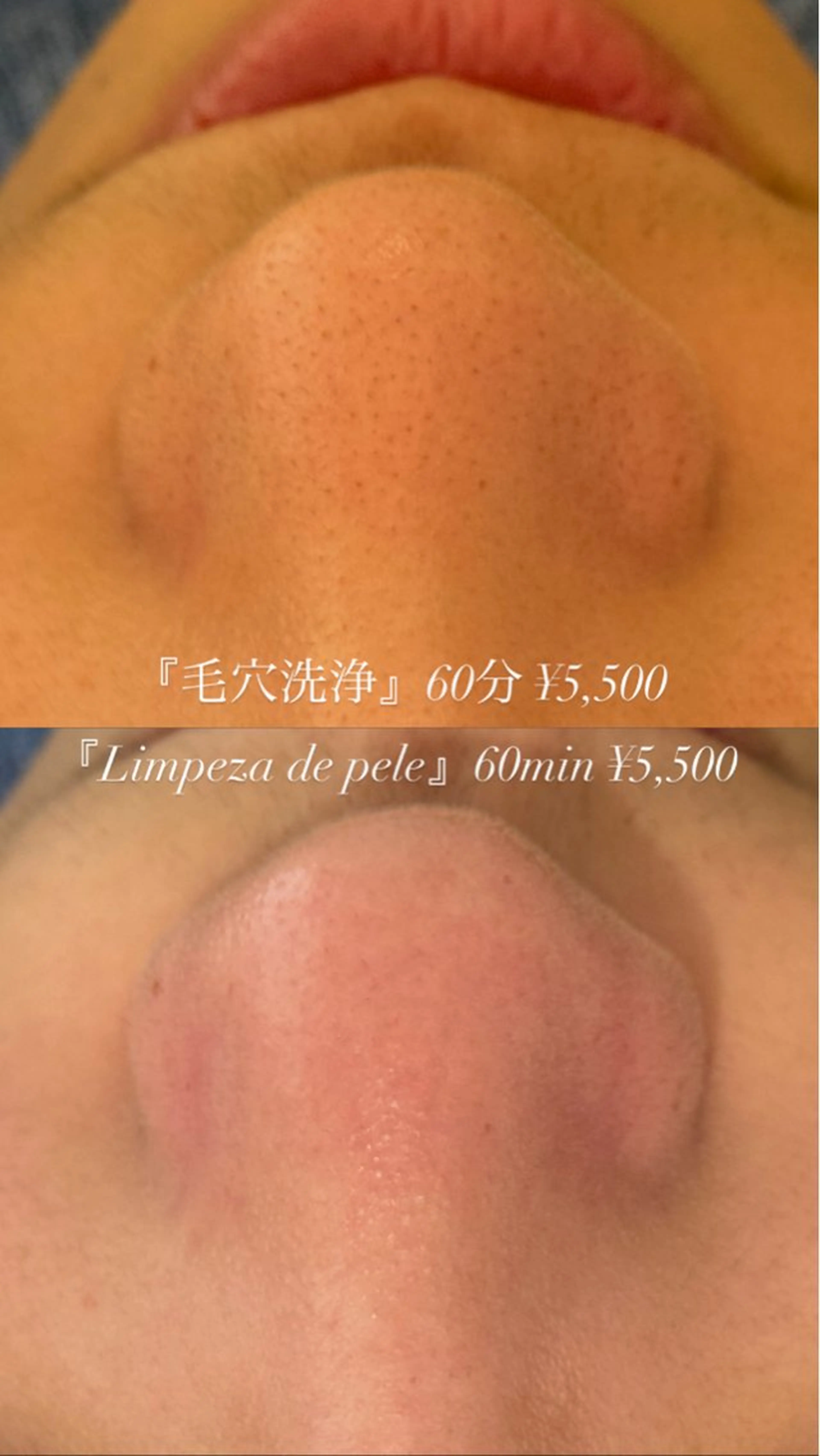 エステ Moki Amandaのエステ・リラクイメージ