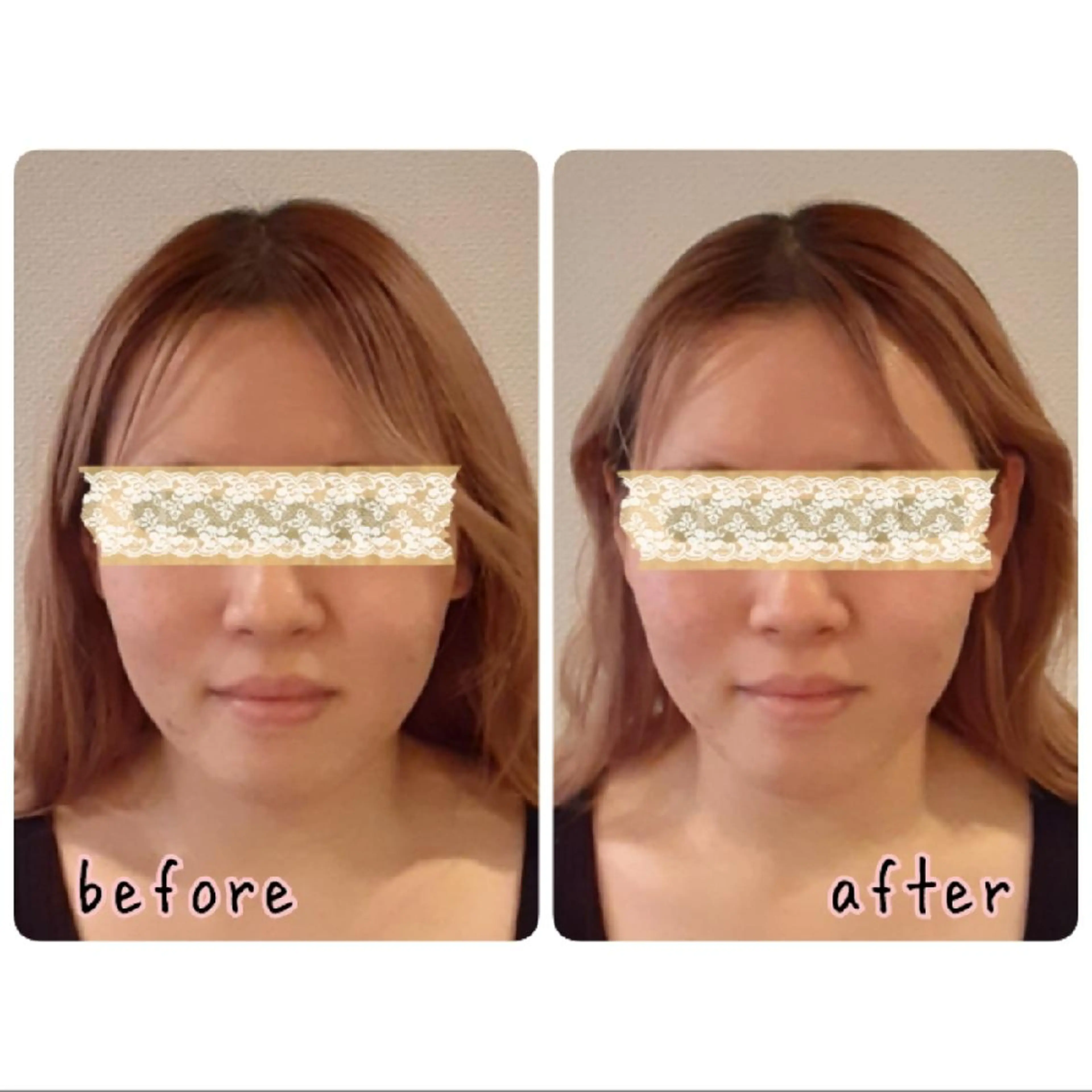 エステ リラク 女性専門 Luna time 整体院所属・Luna time  整体院　金子ゆかのエステ・リラクイメージ