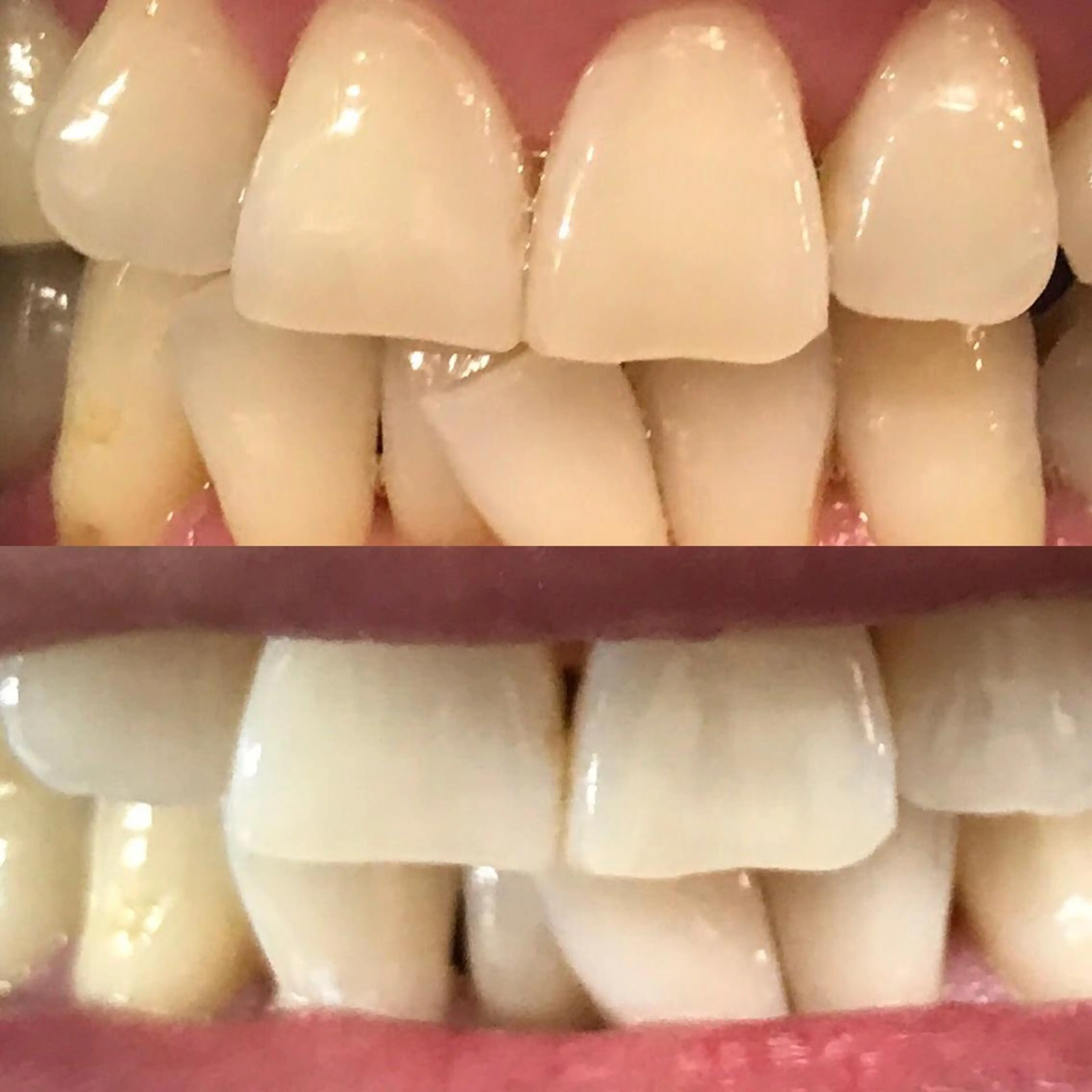 ネイリスト riiisaのネイルデザイン