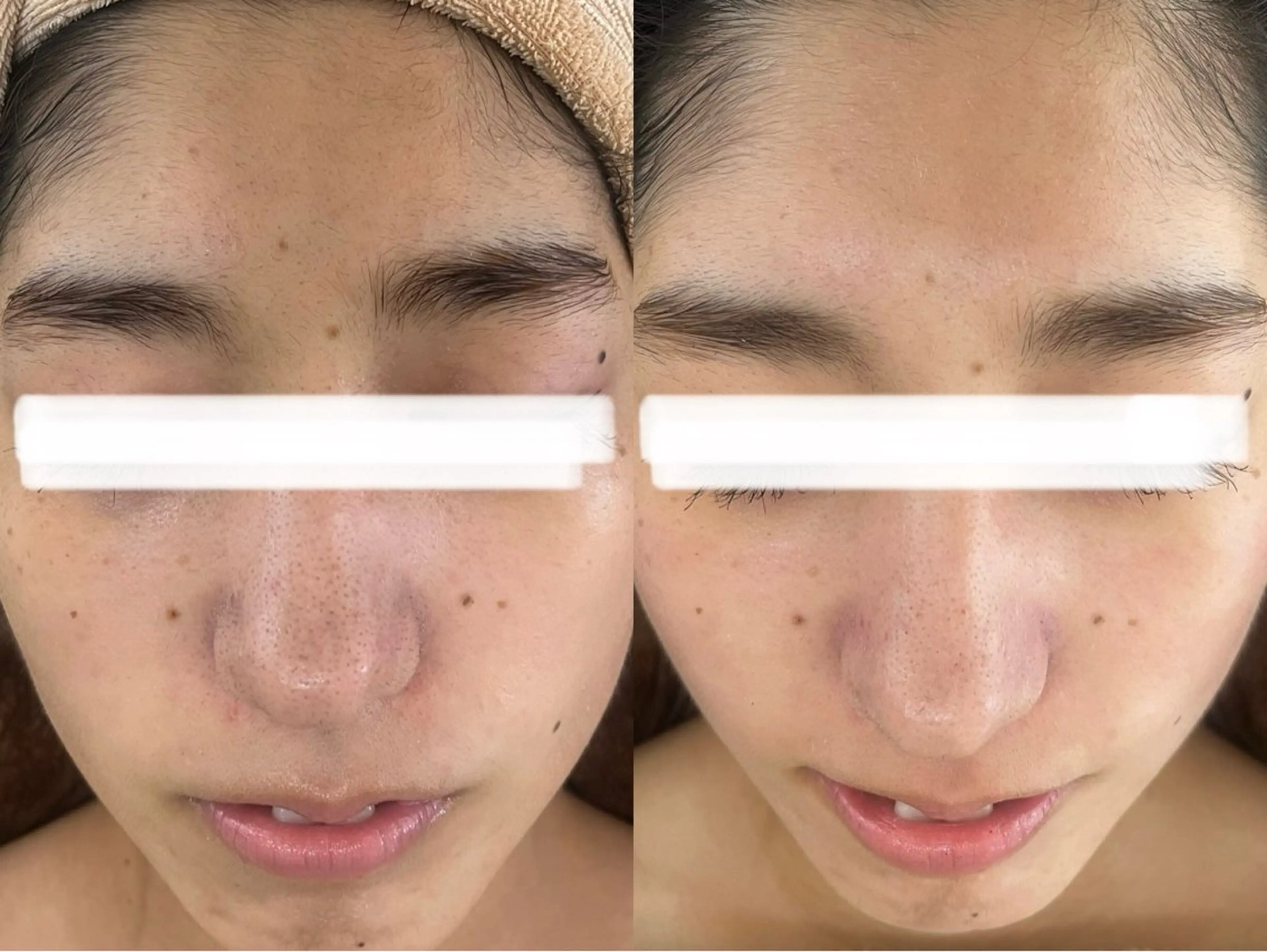 小顔&美肌品川店 Masqueradeのエステ・リラクイメージ