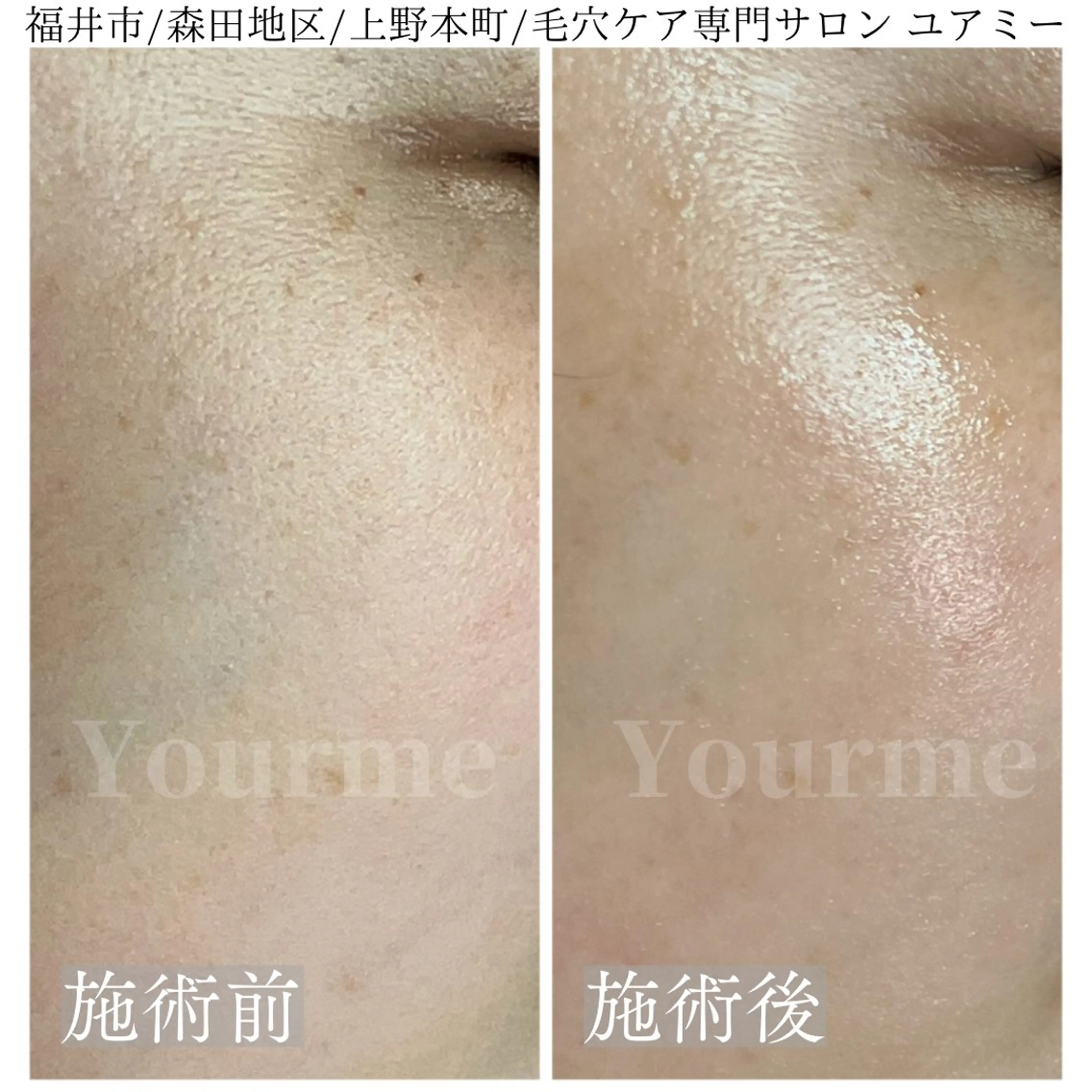 毛穴肌質ケアサロン Yourmeユアミーのエステ・リラクイメージ