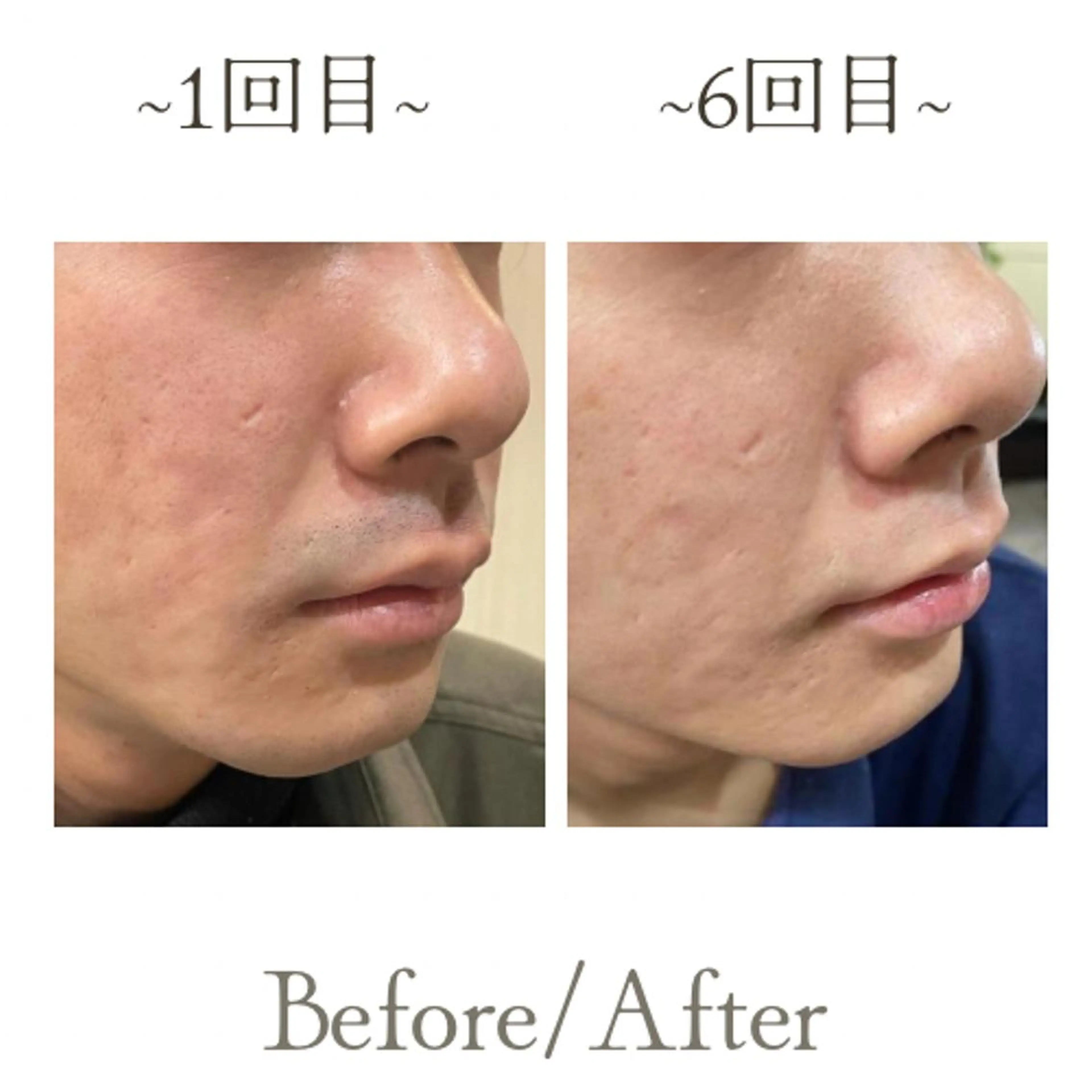 脱毛 メンズサロンGRACE所属・salon GRACEのエステ・リラクイメージ