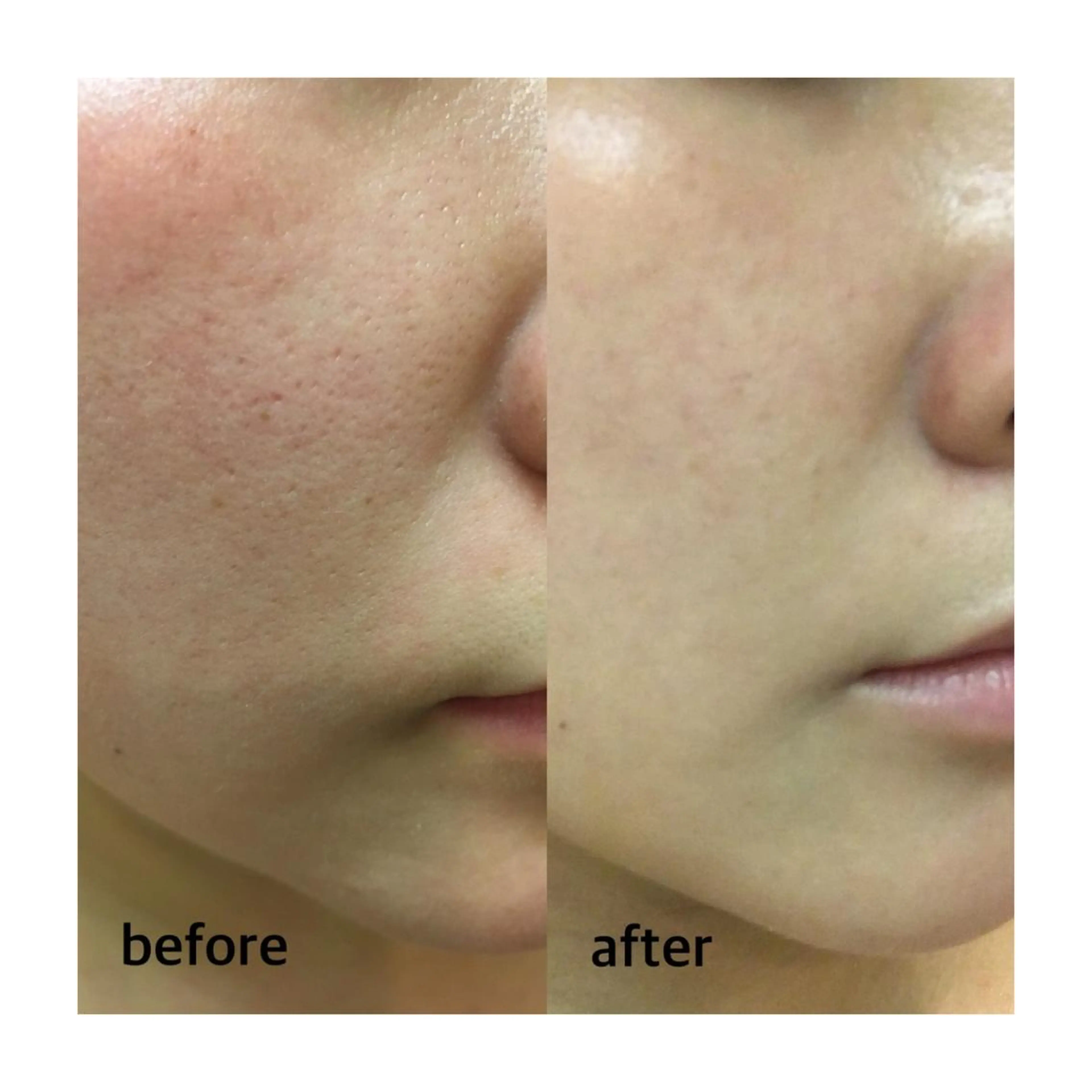 エステ aimee　肌質改善サロン【アイミー】所属・肌質改善サロン aimee｜アイミーのエステ・リラクイメージ