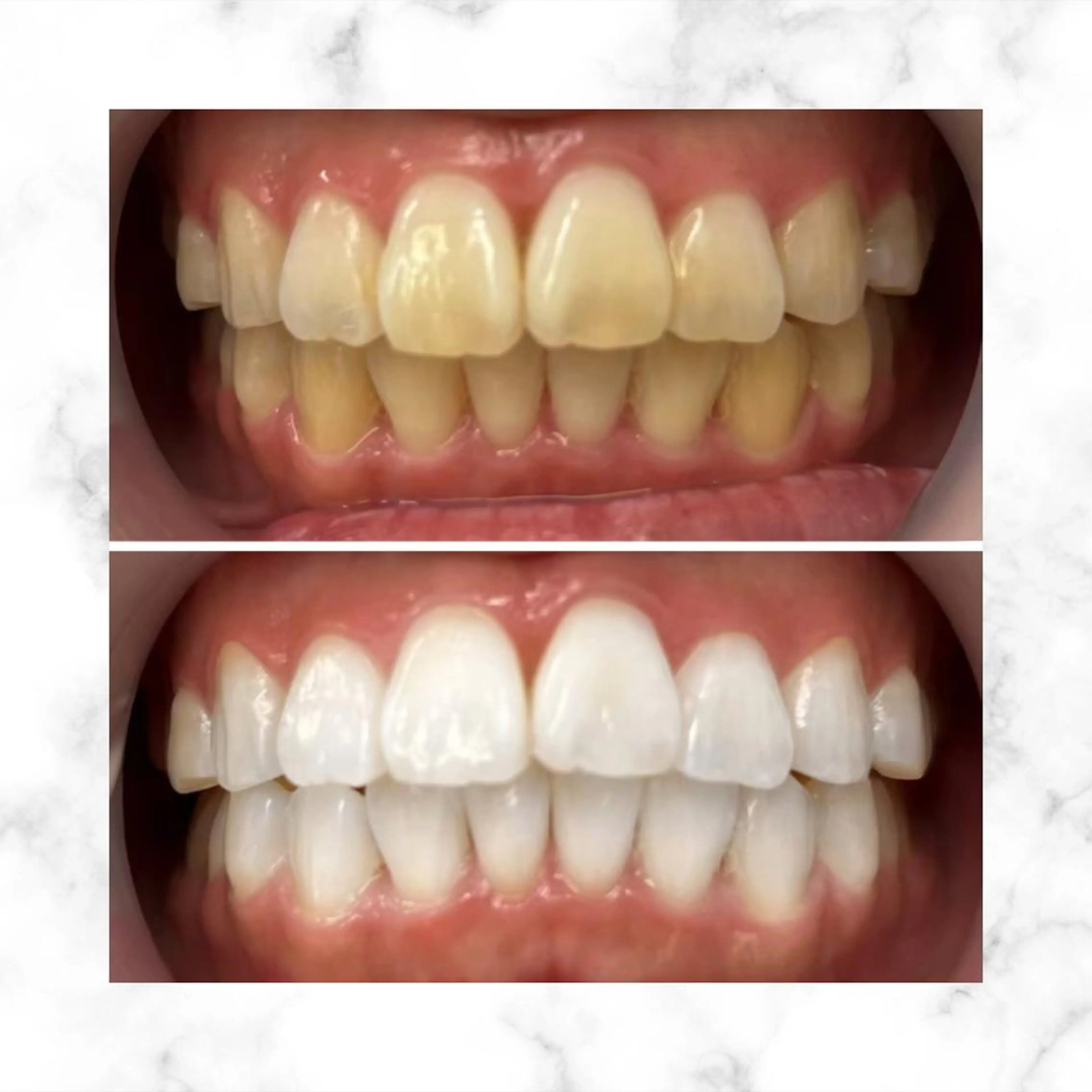 LBSホワイトニング 🌐渋谷店スタッフのエステ・リラクイメージ