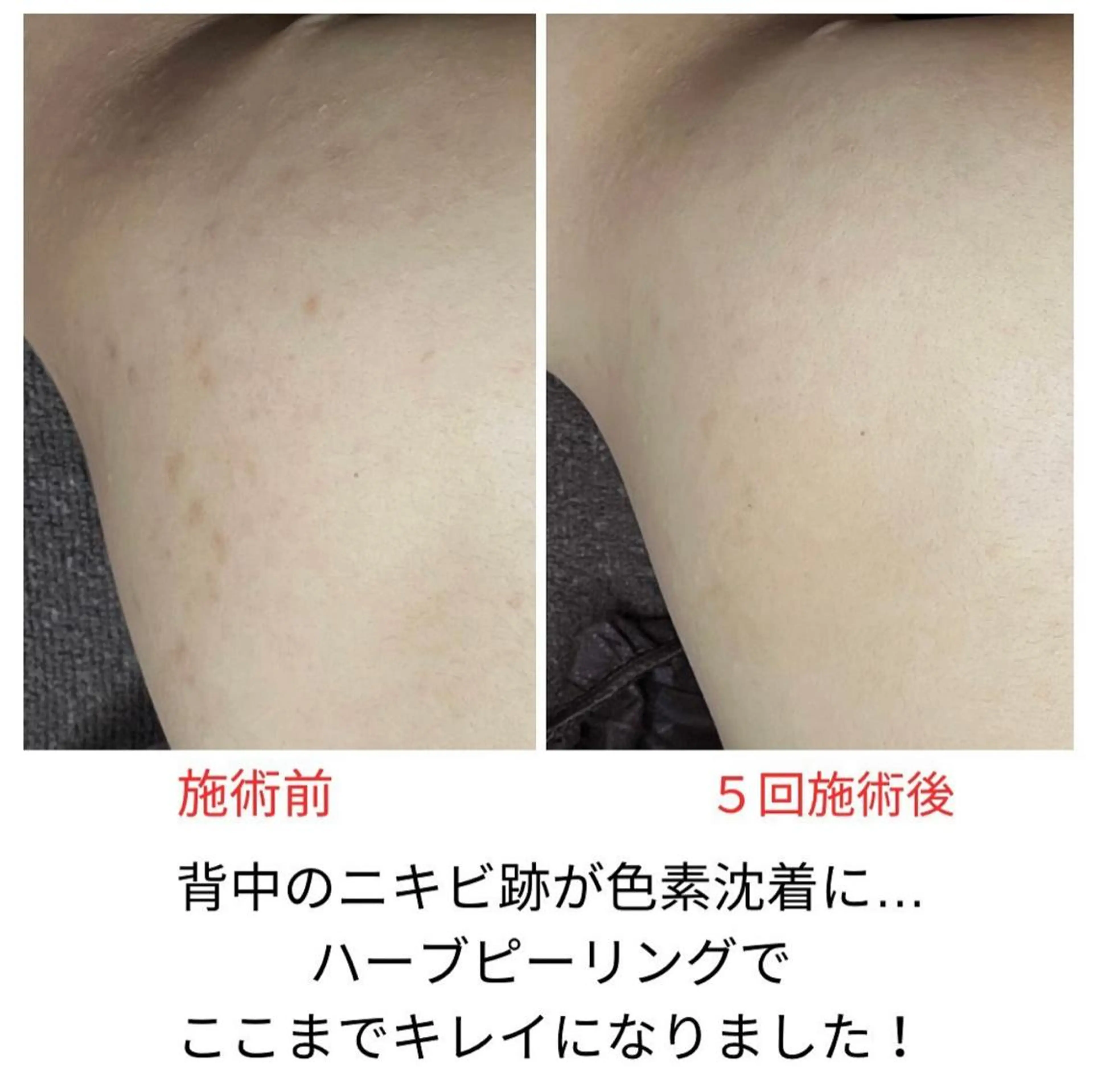 ベラージュ【美背中・ 美尻・フェイシャル】のエステ・リラクイメージ