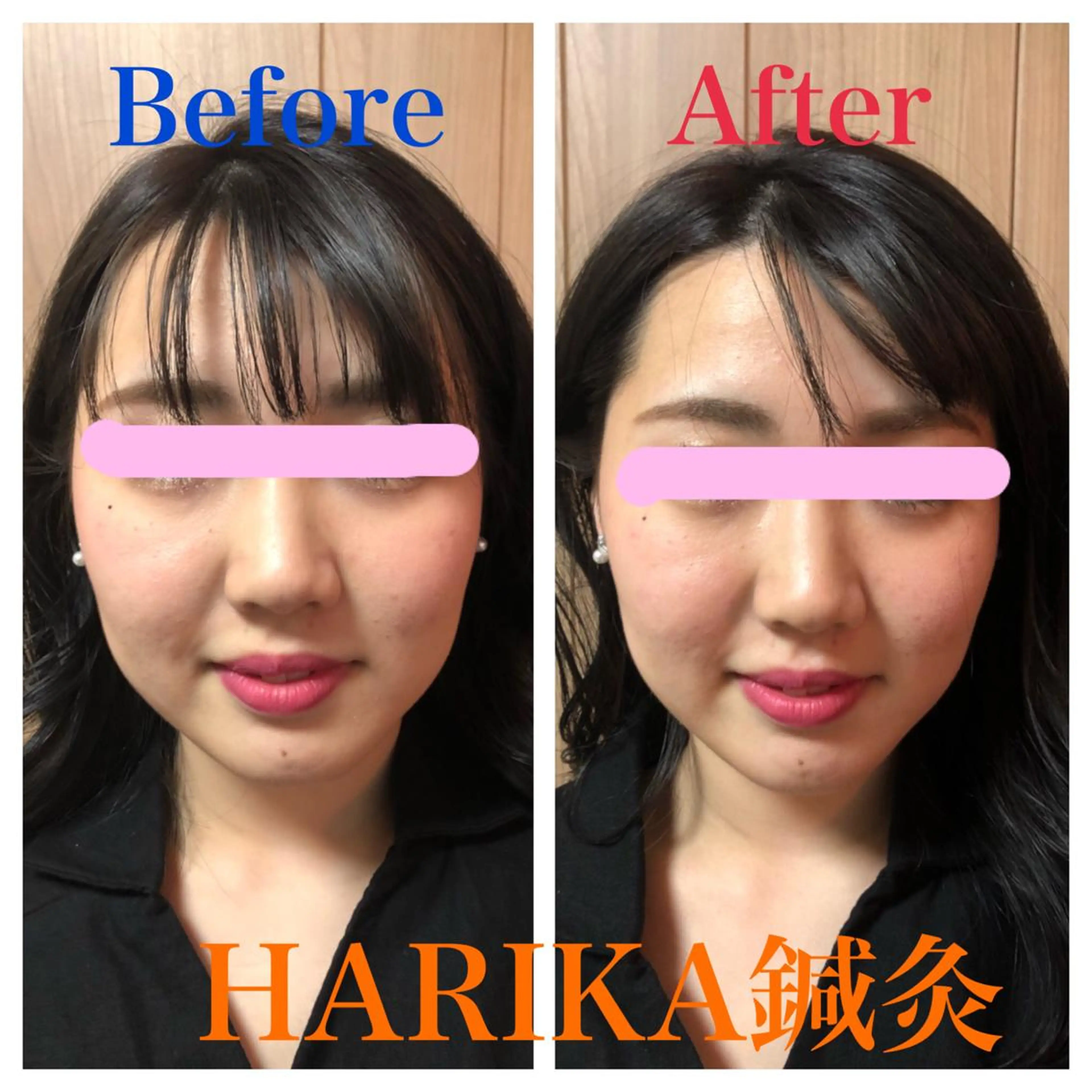 HARIKA鍼灸所属・HARIKA 鍼灸のその他イメージ