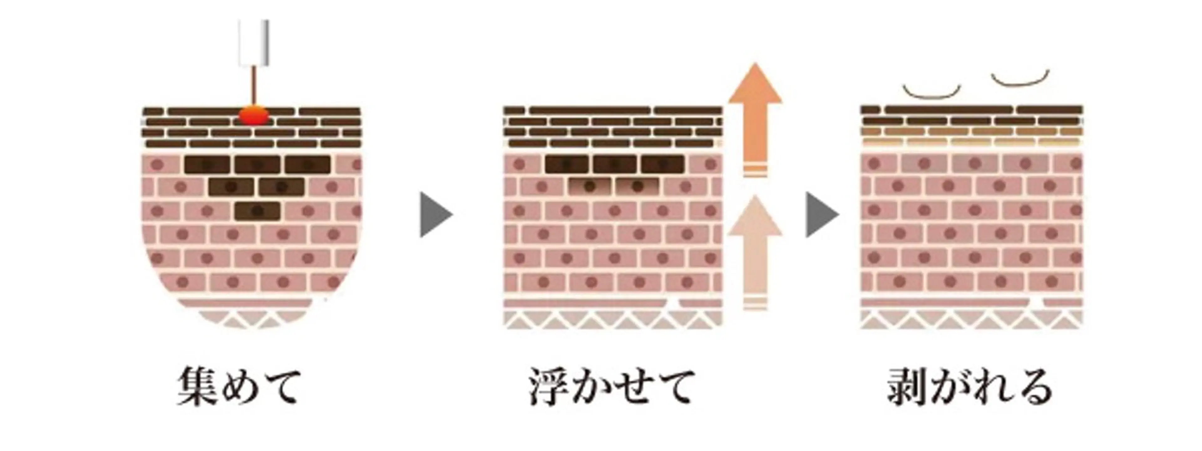 LiZA エステティックサロンのエステ・リラクイメージ