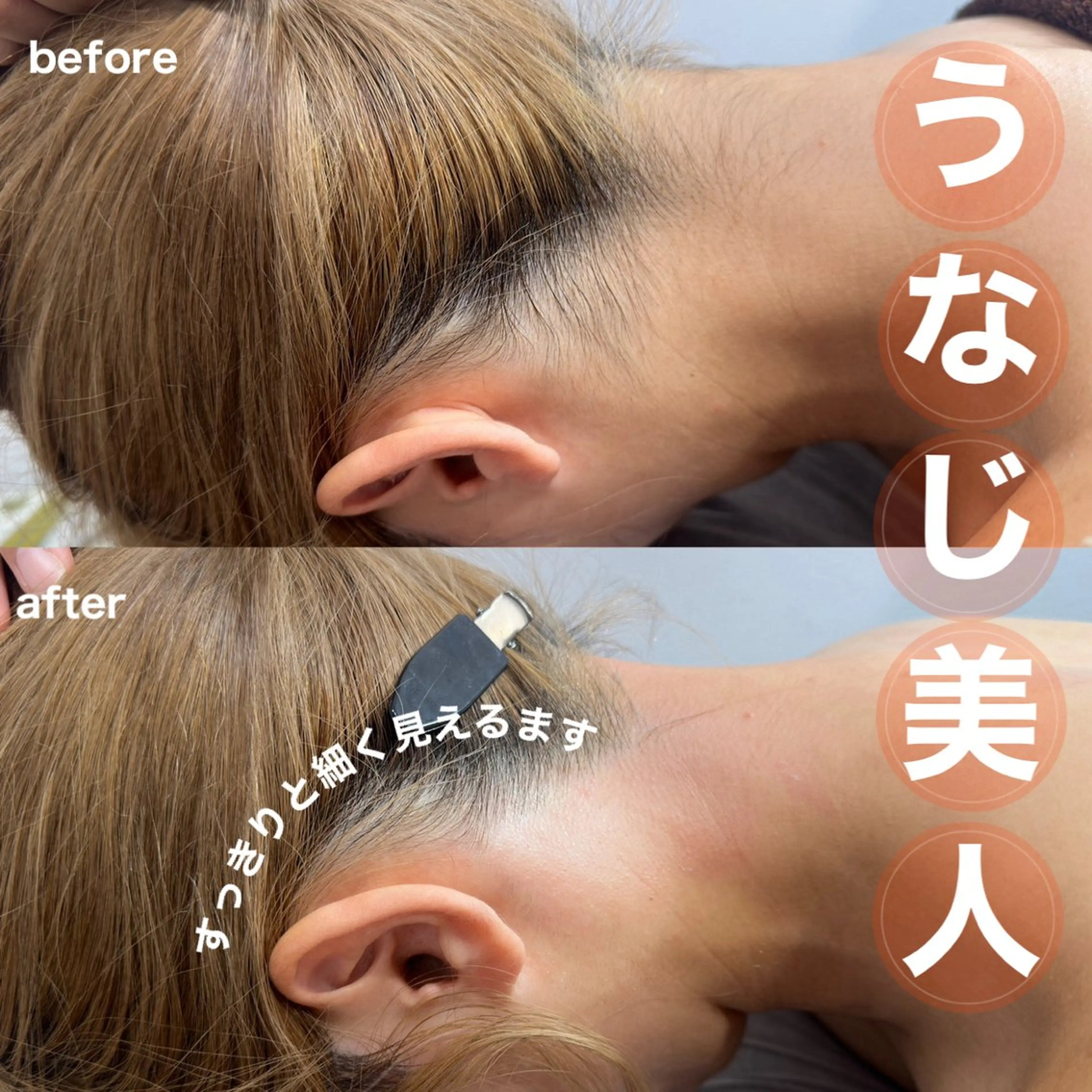 🧜🏻♀️うなじダブル脱毛(WAX+SHR光脱毛)の写真