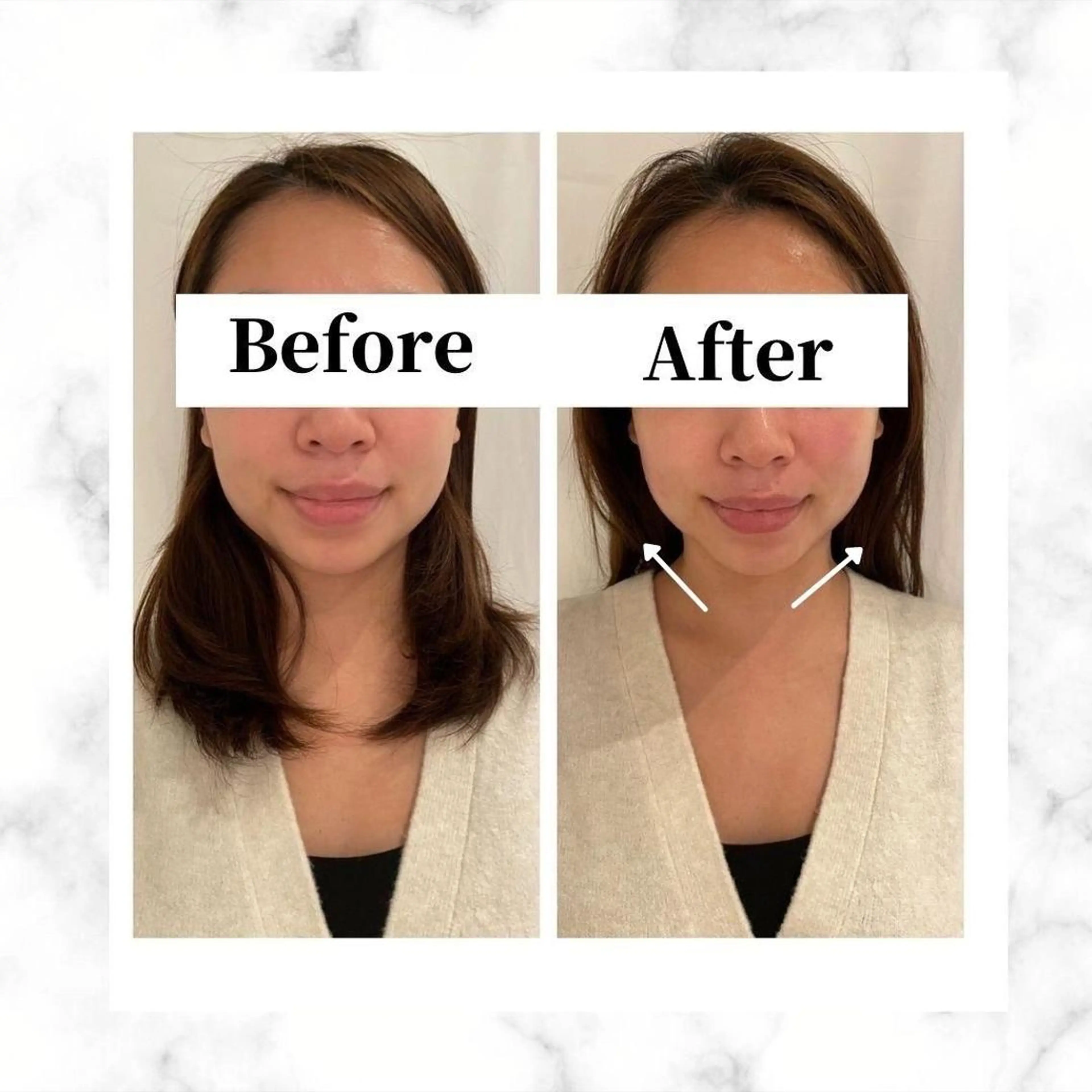 エステ リラク 12Dハイフ💗 最強小顔のエステ・リラクイメージ