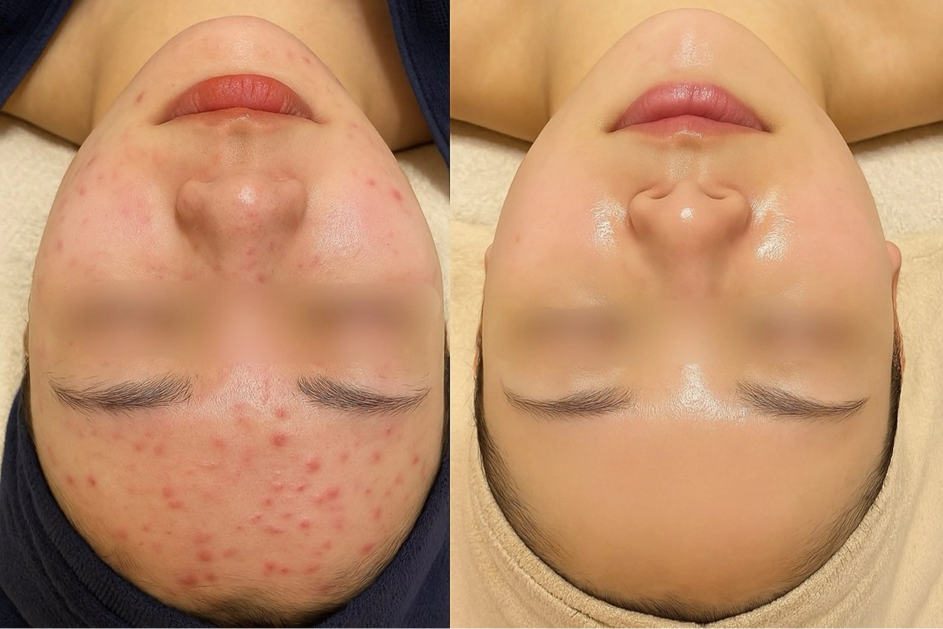 エステ Flourb所属・ハーブピーリング専門 サロンFlourbのエステ・リラクイメージ