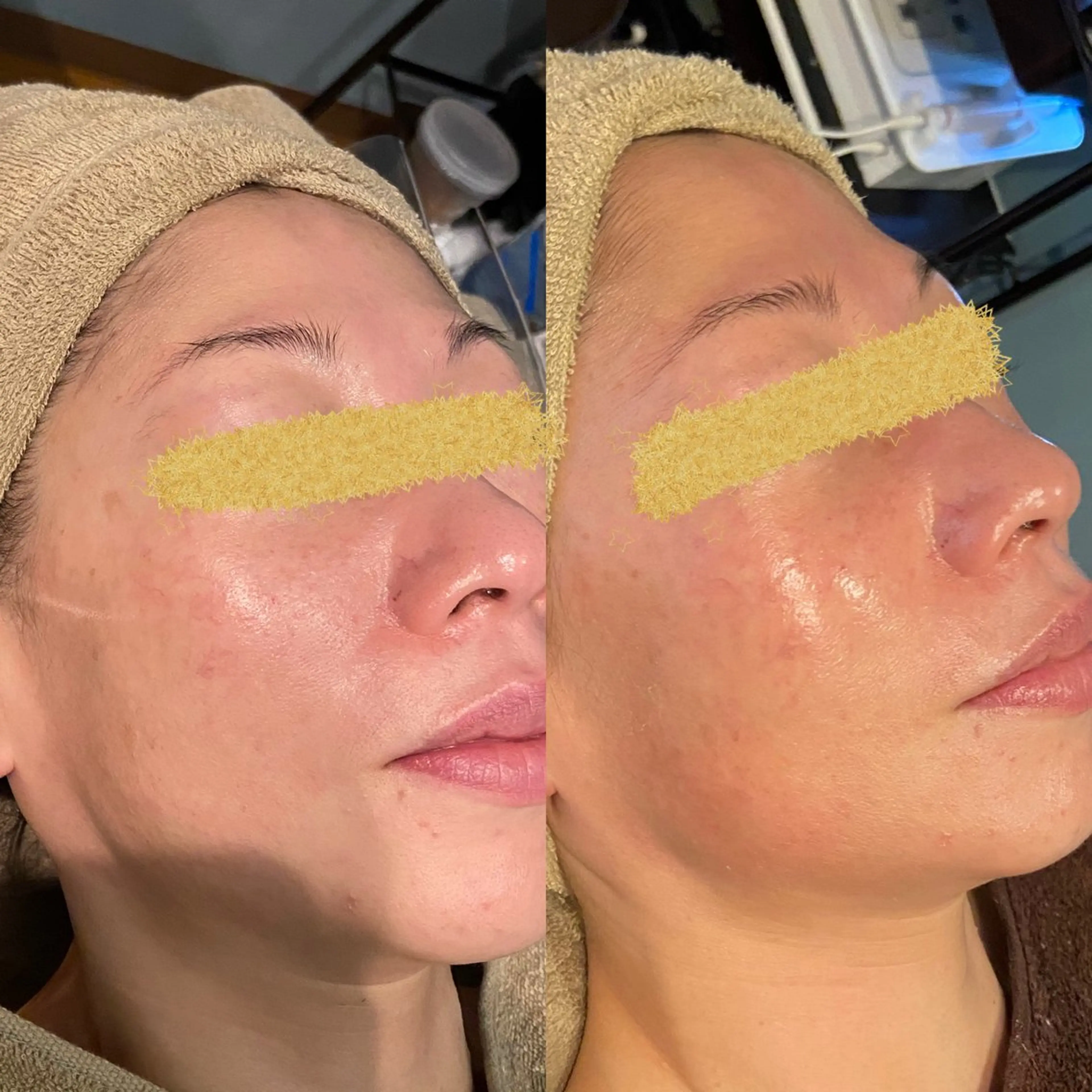 その他 petit Orb所属・petit Orb 大谷梨紗のエステ・リラクイメージ