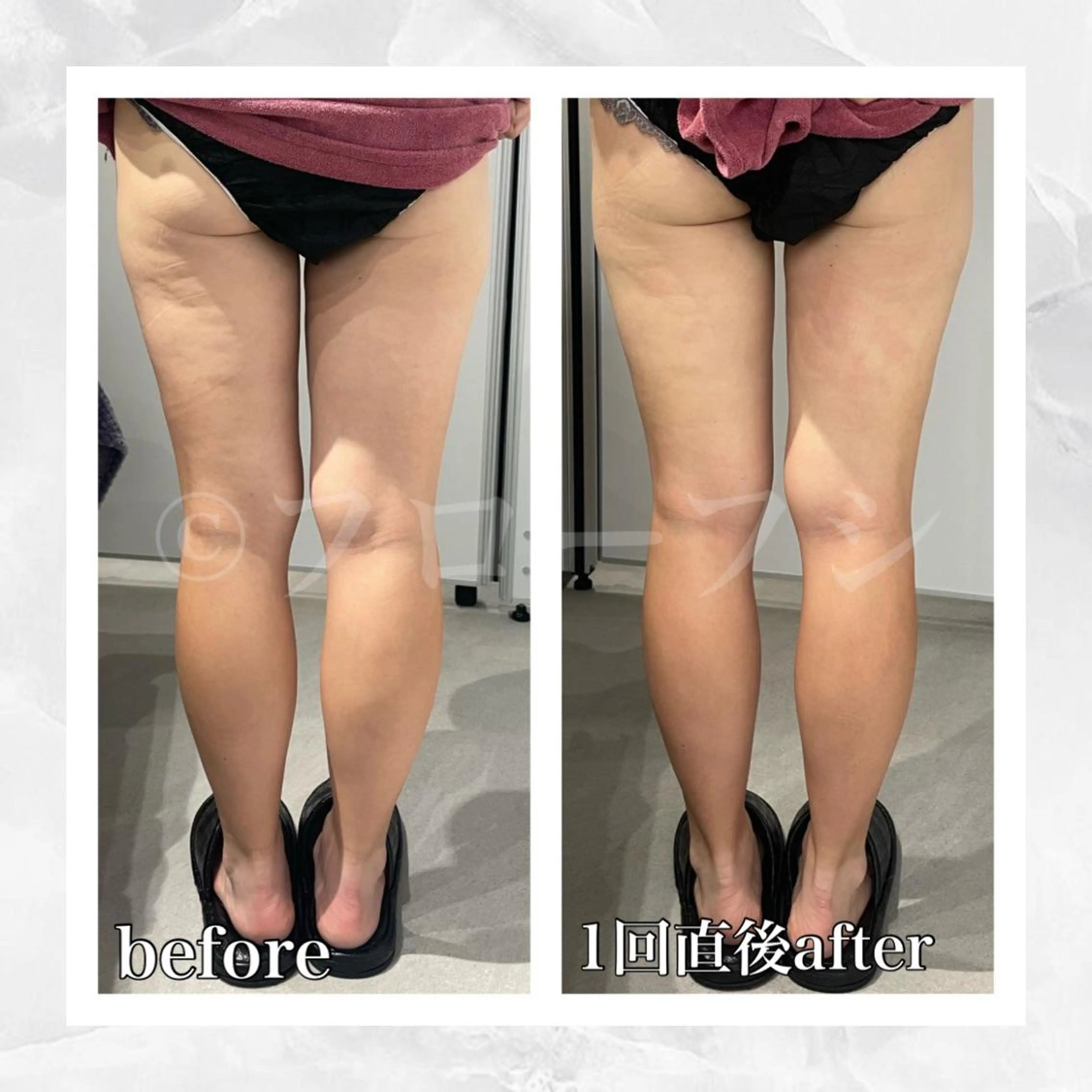 エステ リラク 部分痩せ♥️小顔専門 MIKUのエステ・リラクイメージ