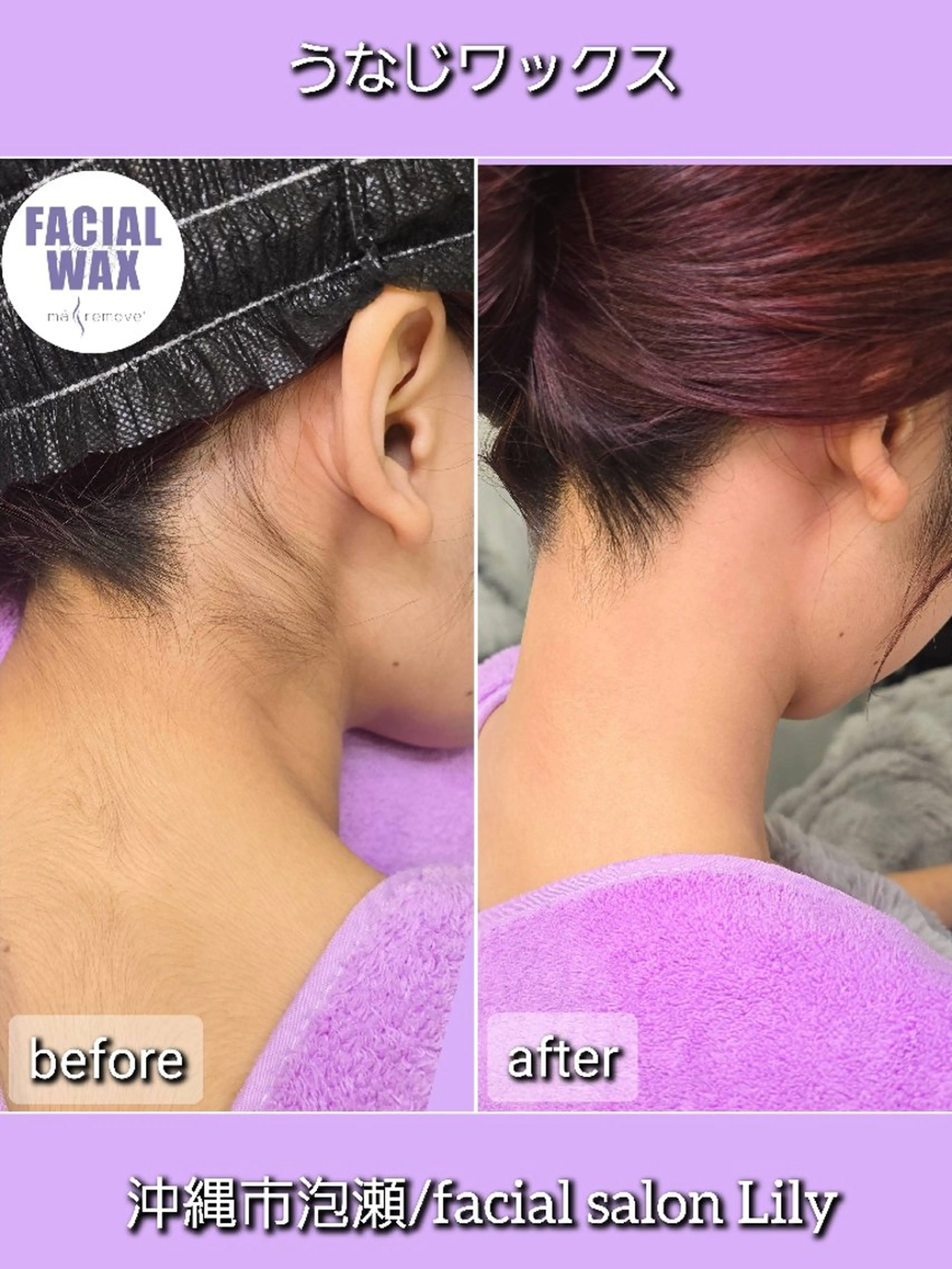 脱毛 facial salon Lily所属・salon Lilyのエステ・リラクイメージ