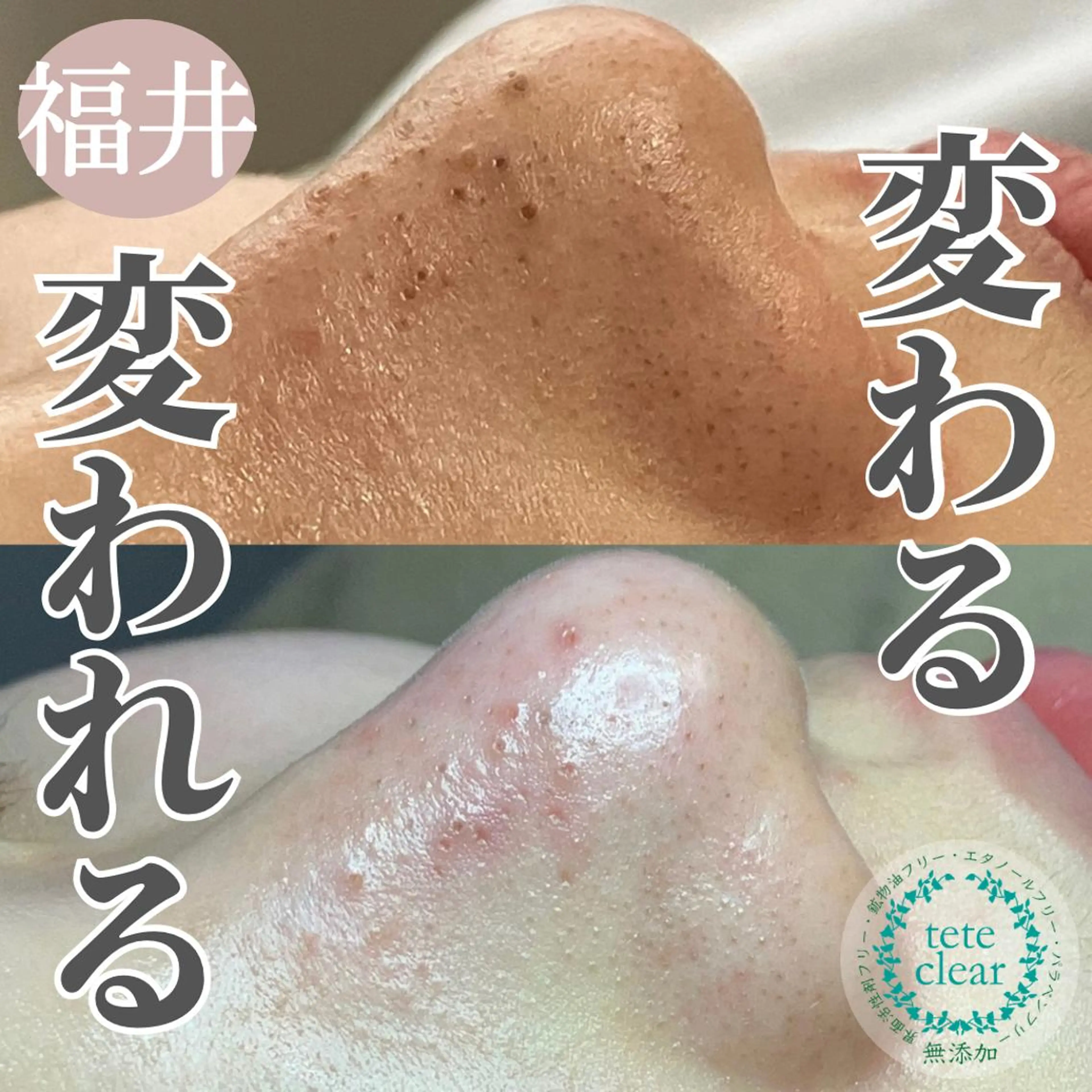 毛穴肌質ケアサロン Yourmeユアミーのエステ・リラクイメージ