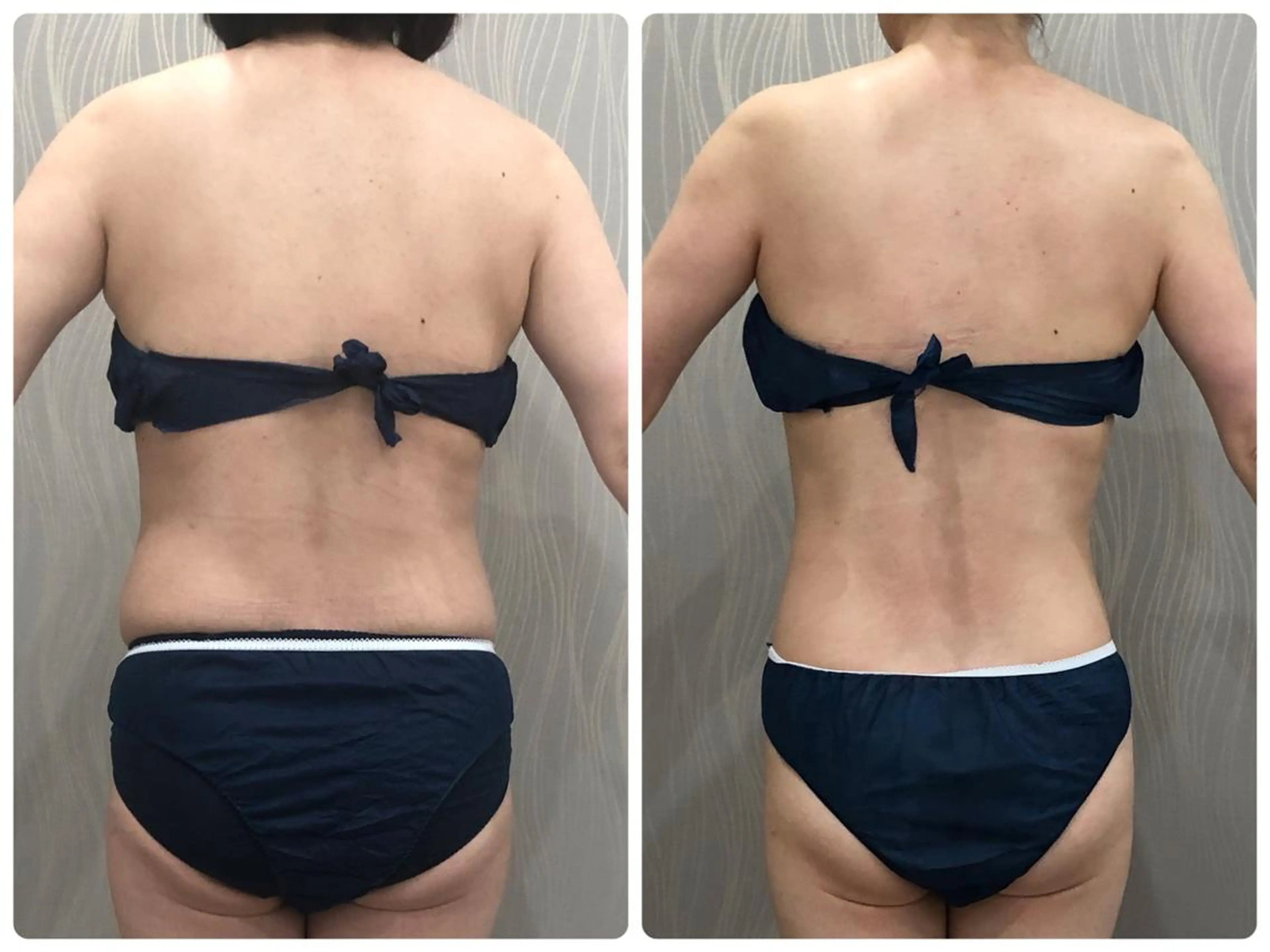 エステティックサロン ベルネのエステ・リラクイメージ