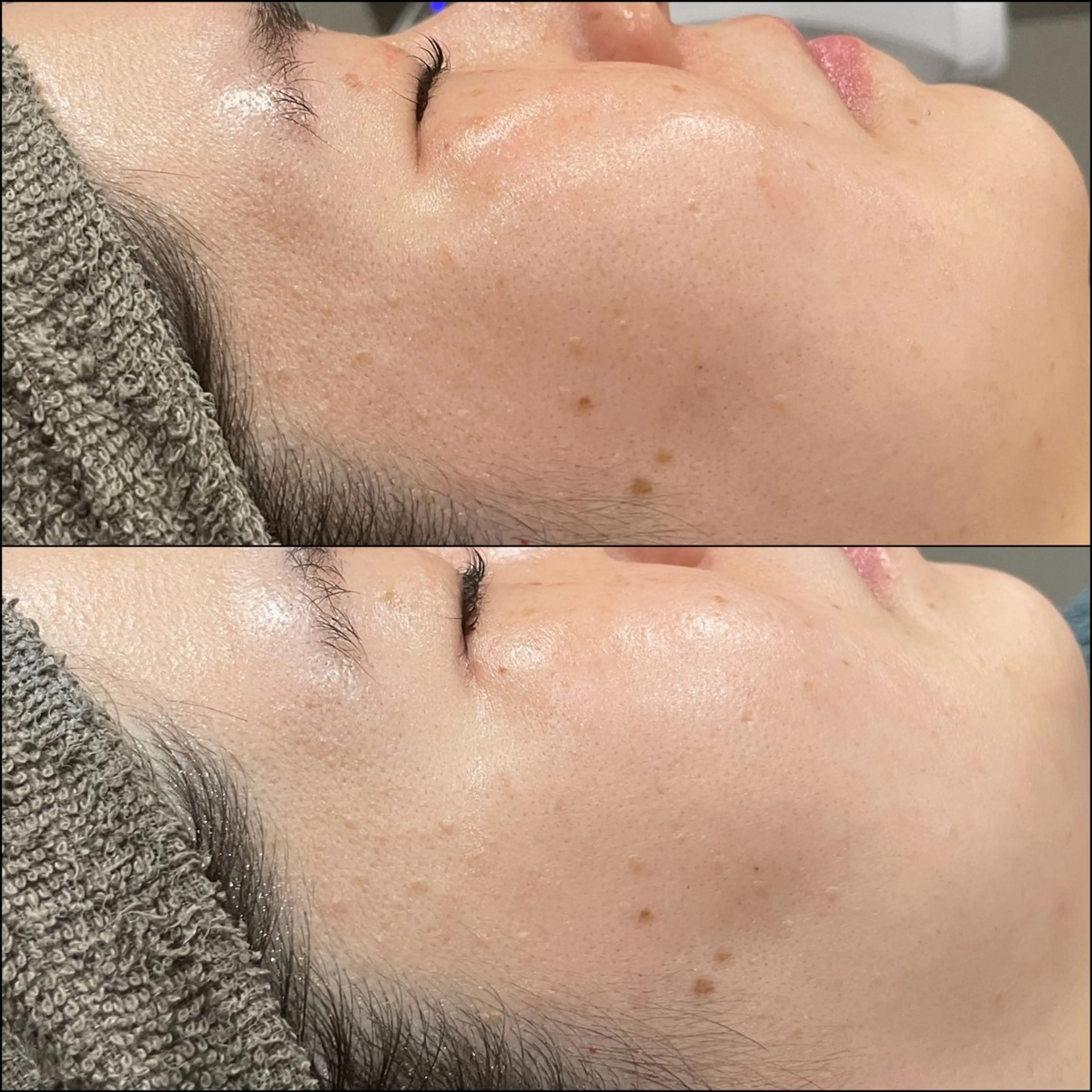 脱毛 LiZA エステティックサロンのエステ・リラクイメージ