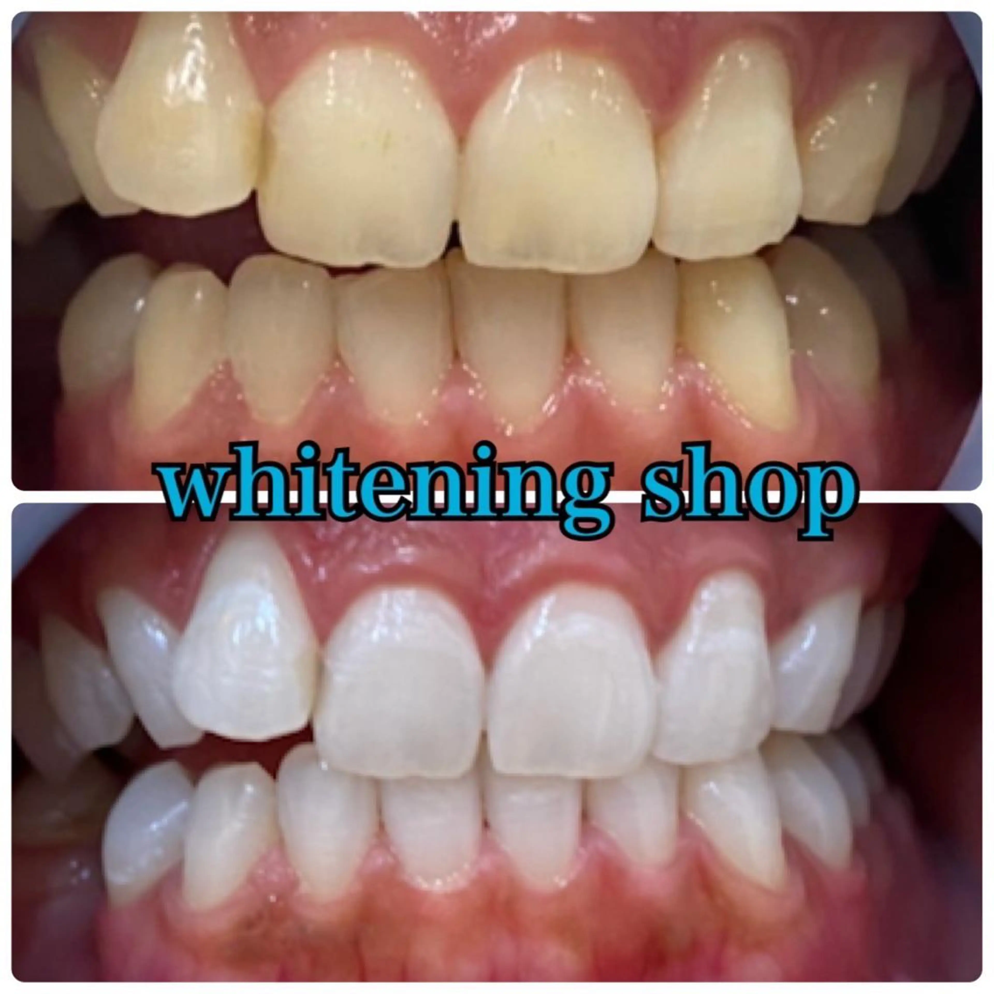 その他 ホワイトニング ショップ千葉店のその他イメージ