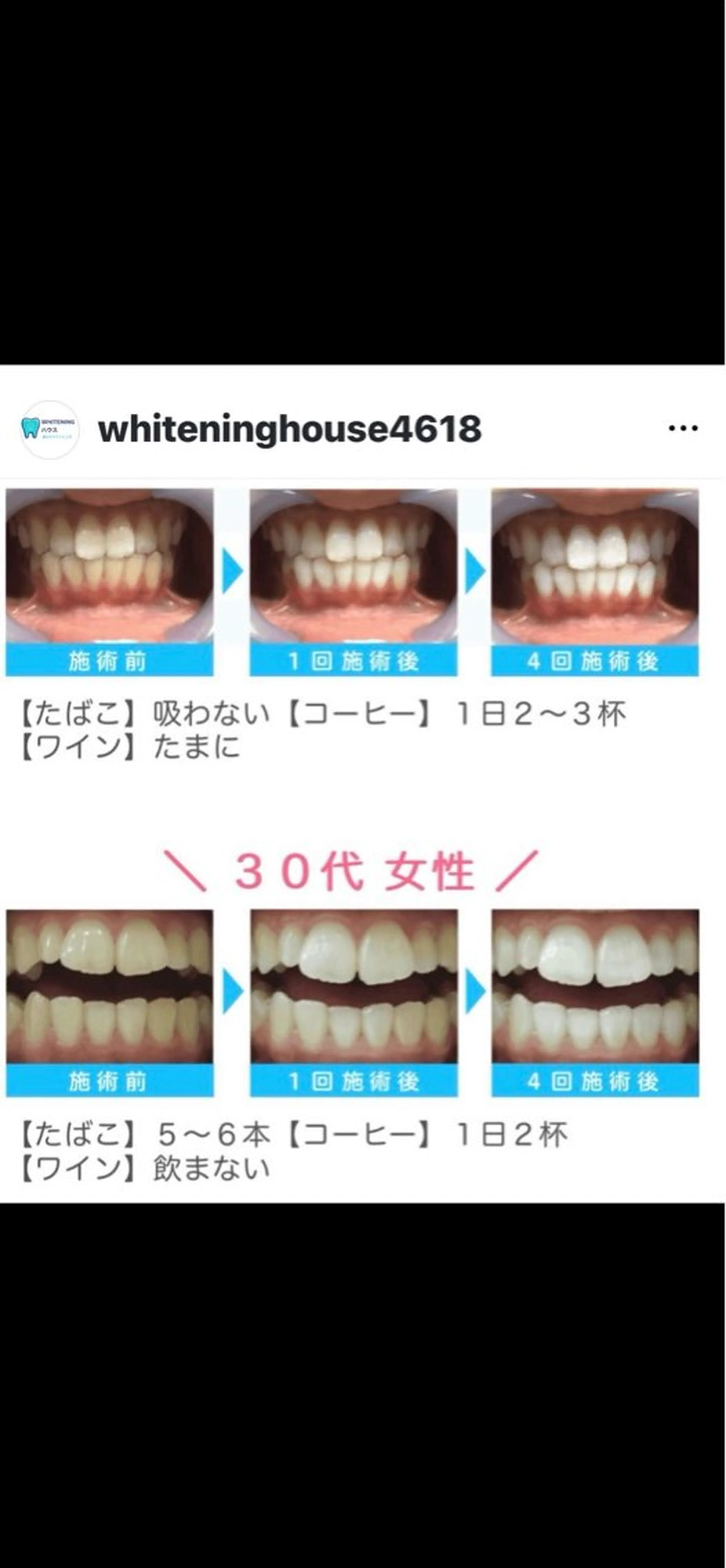 WHITENING ハウスのマツエク・マツパデザイン