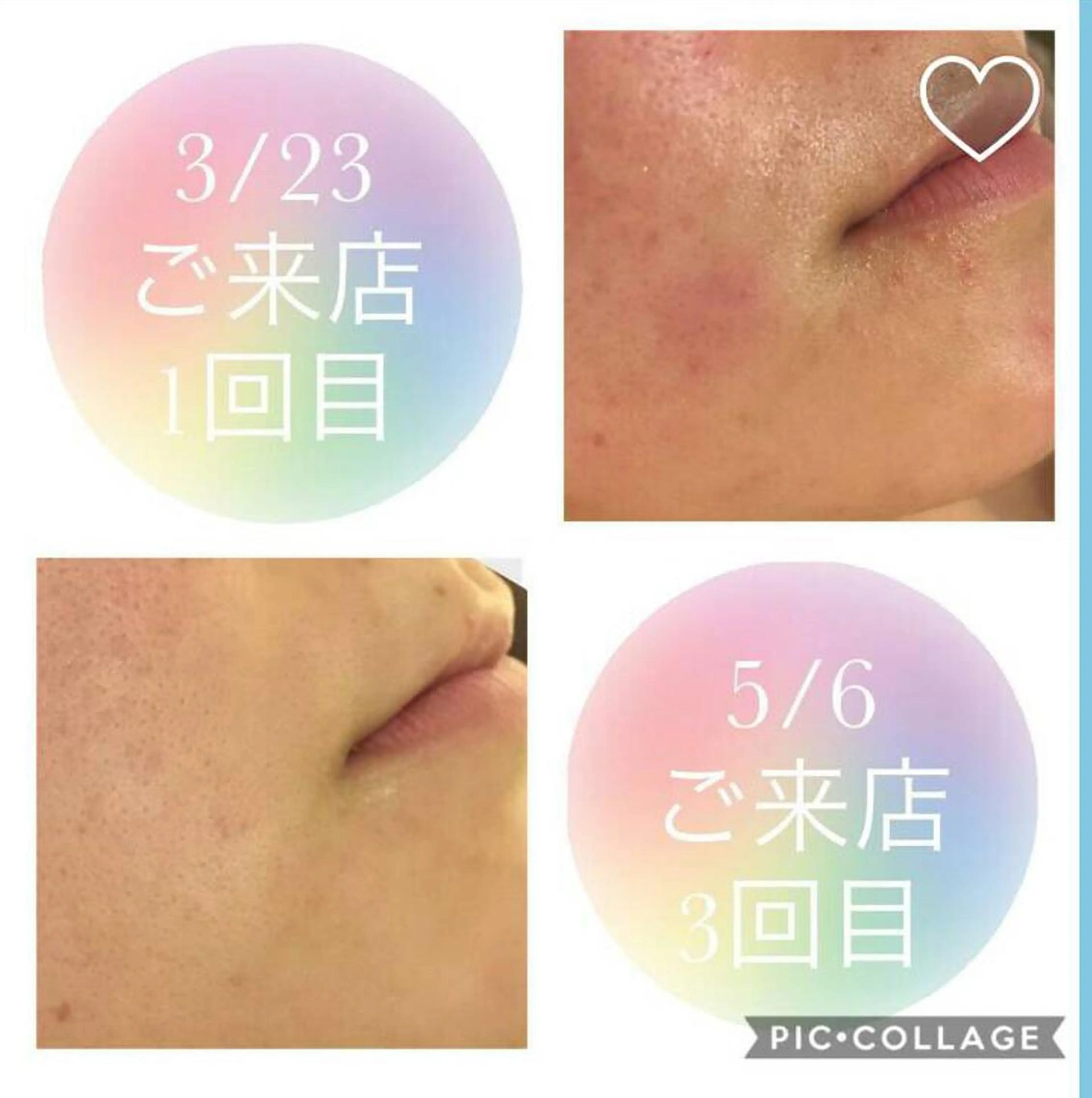 痩身リンパダイエット 隠れ家サロンチャームのエステ・リラクイメージ