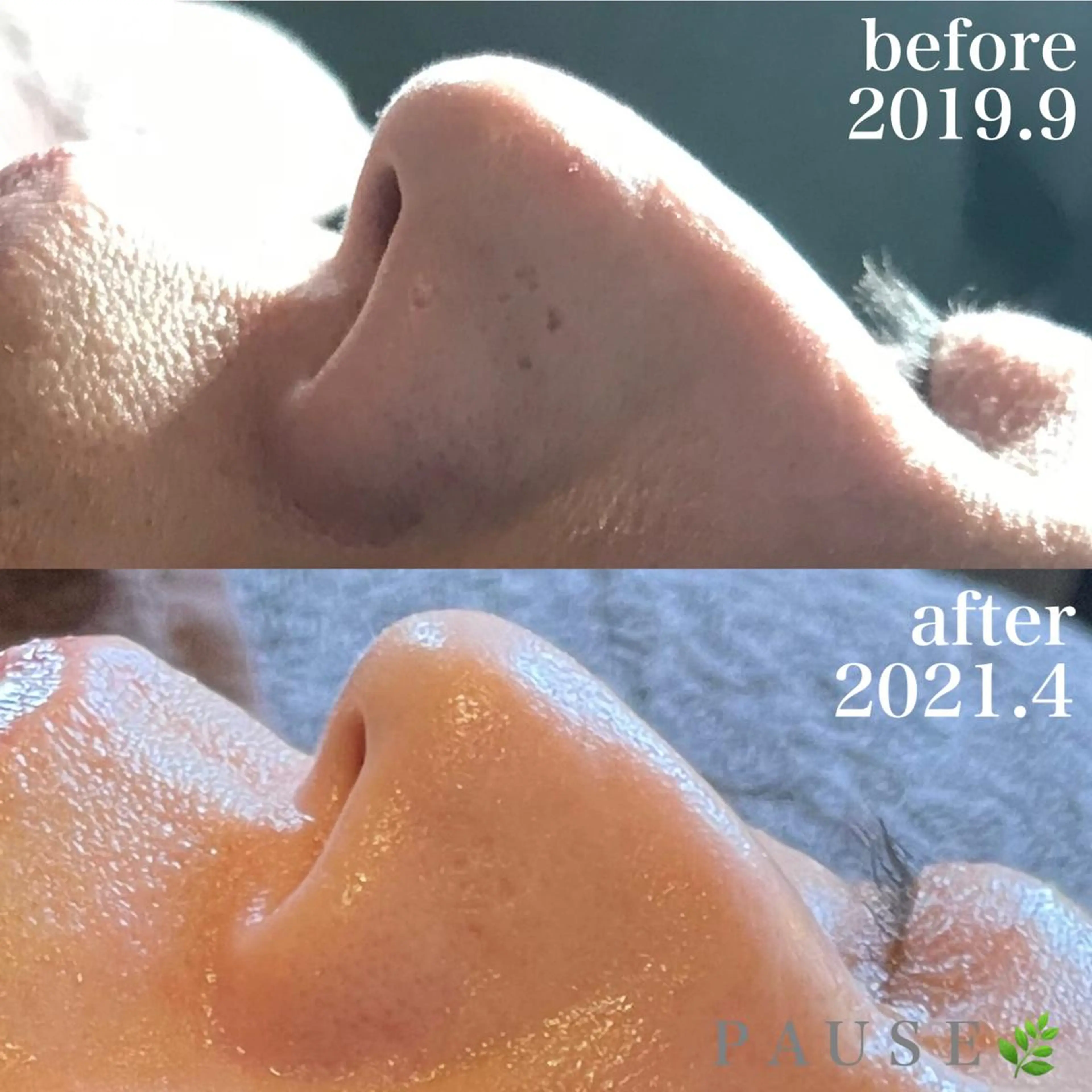 エステ 浜野 恵美のエステ・リラクイメージ