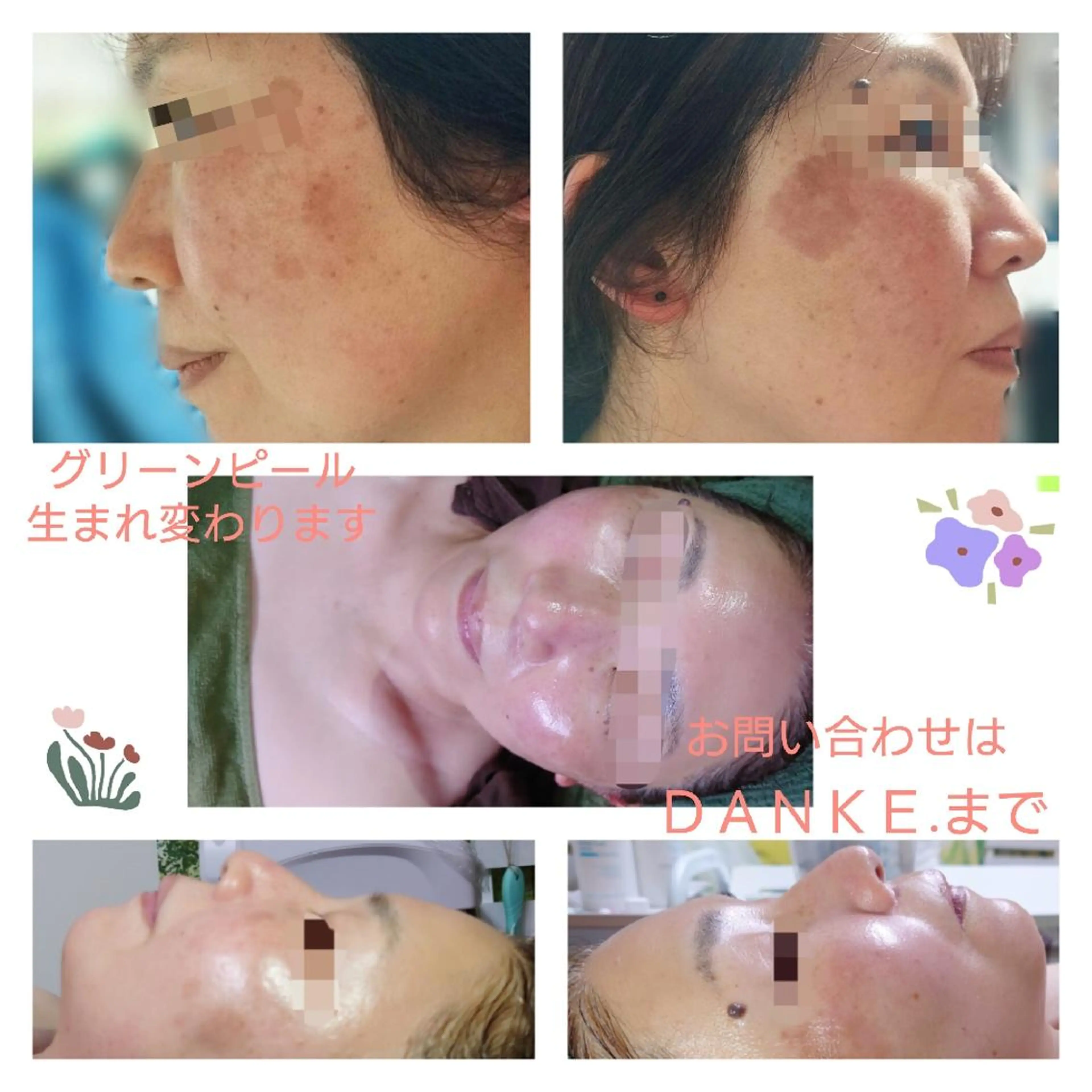 ＤＡＮＫＥ. サポートナースゆうこのエステ・リラクイメージ