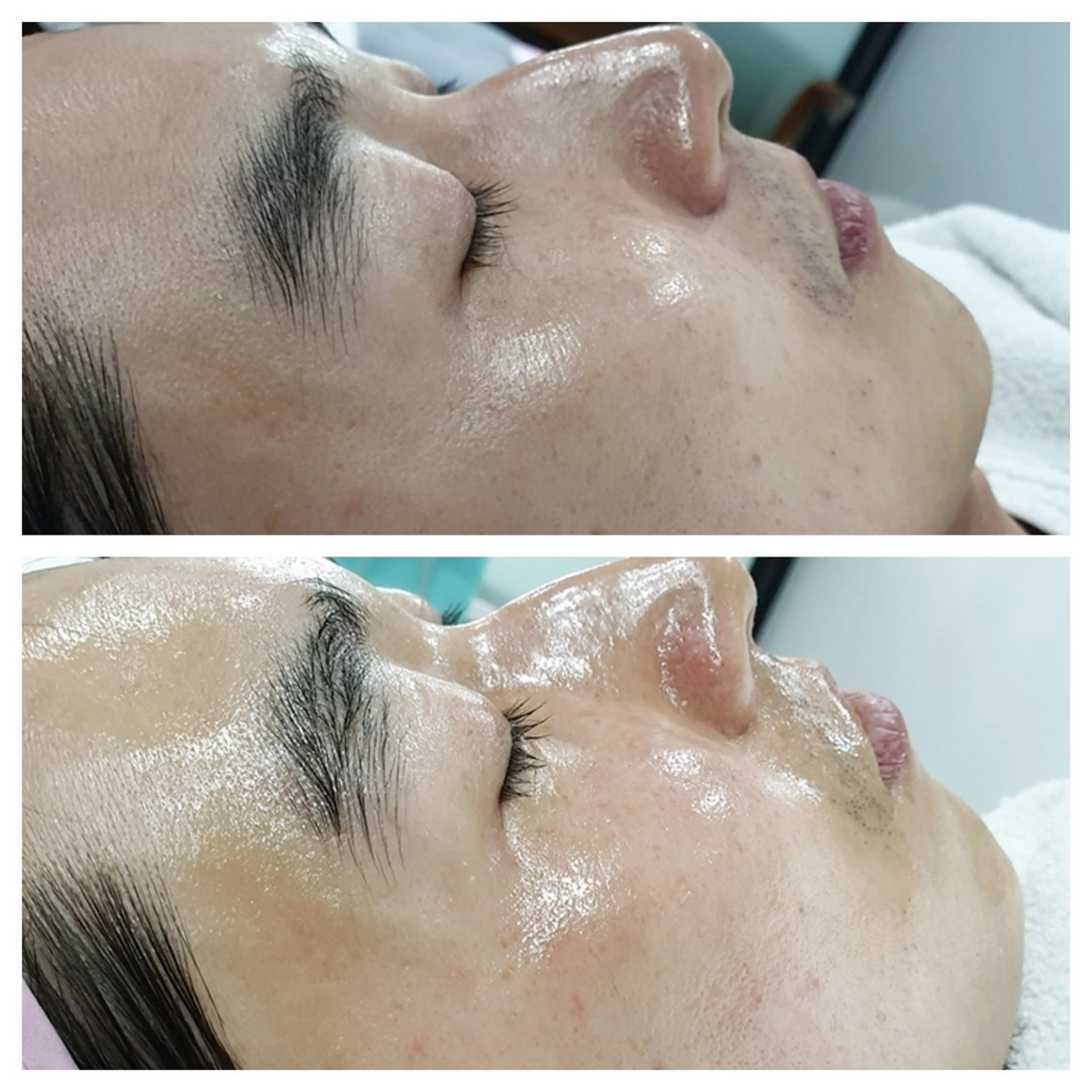 라라피（ララピ）所属・韓国式肌管理 ララピール専門のエステ・リラクイメージ