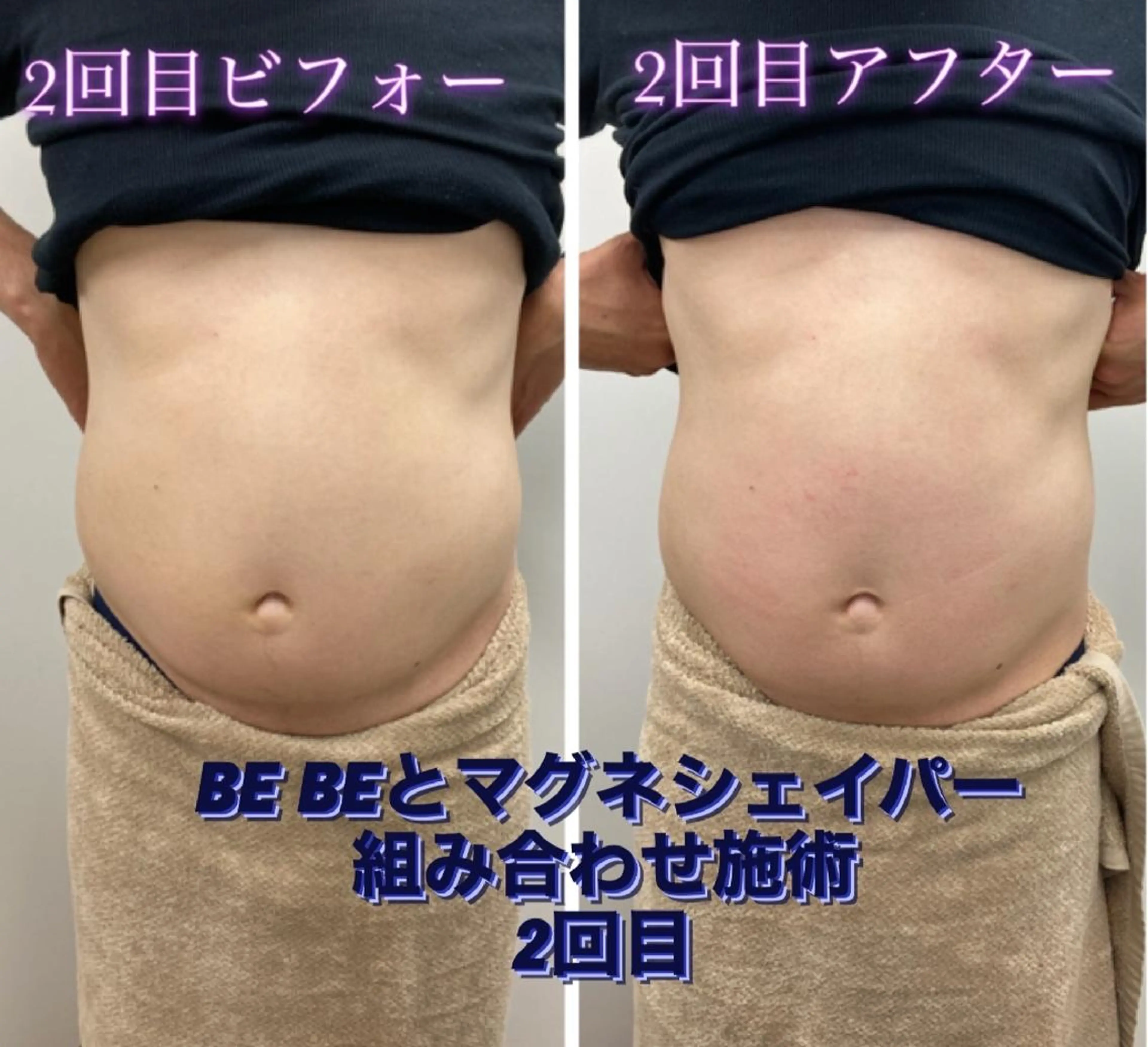 ショールームエステbeco所属・ショールームエステ becoのエステ・リラクイメージ