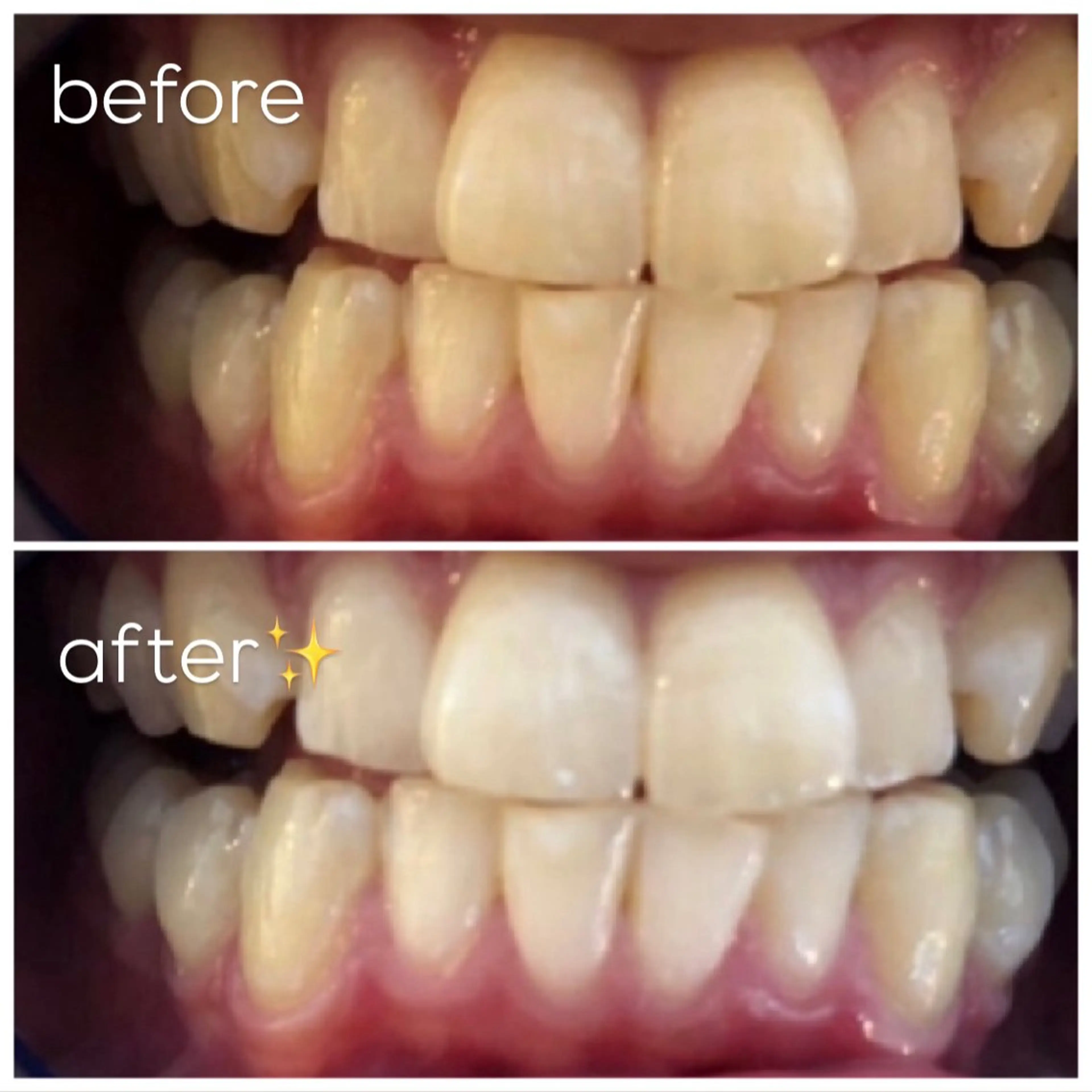 エクシア津駅前店所属・セルフホワイトニング エクシア津駅前店のその他イメージ