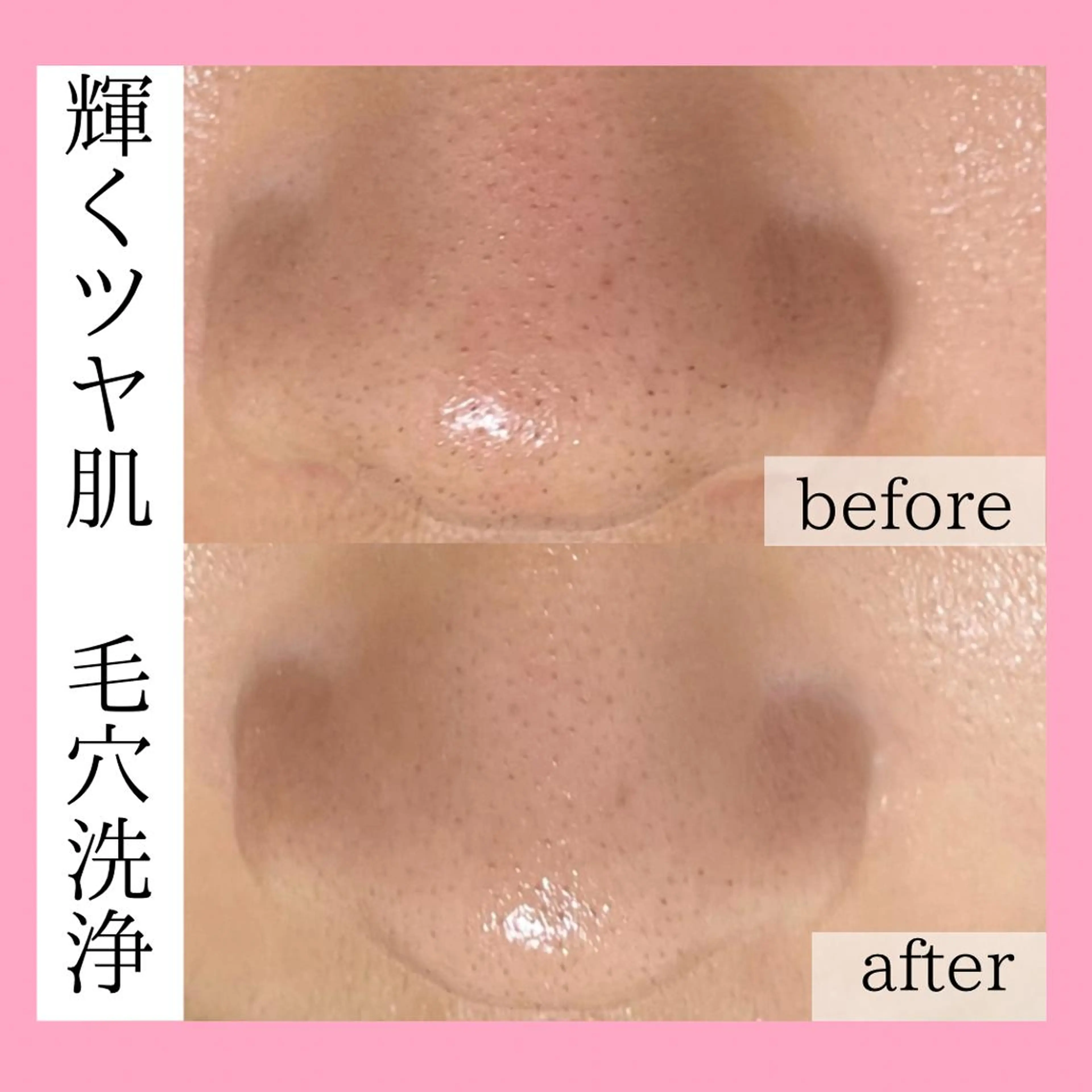 てらもと ほのかのエステ・リラクイメージ