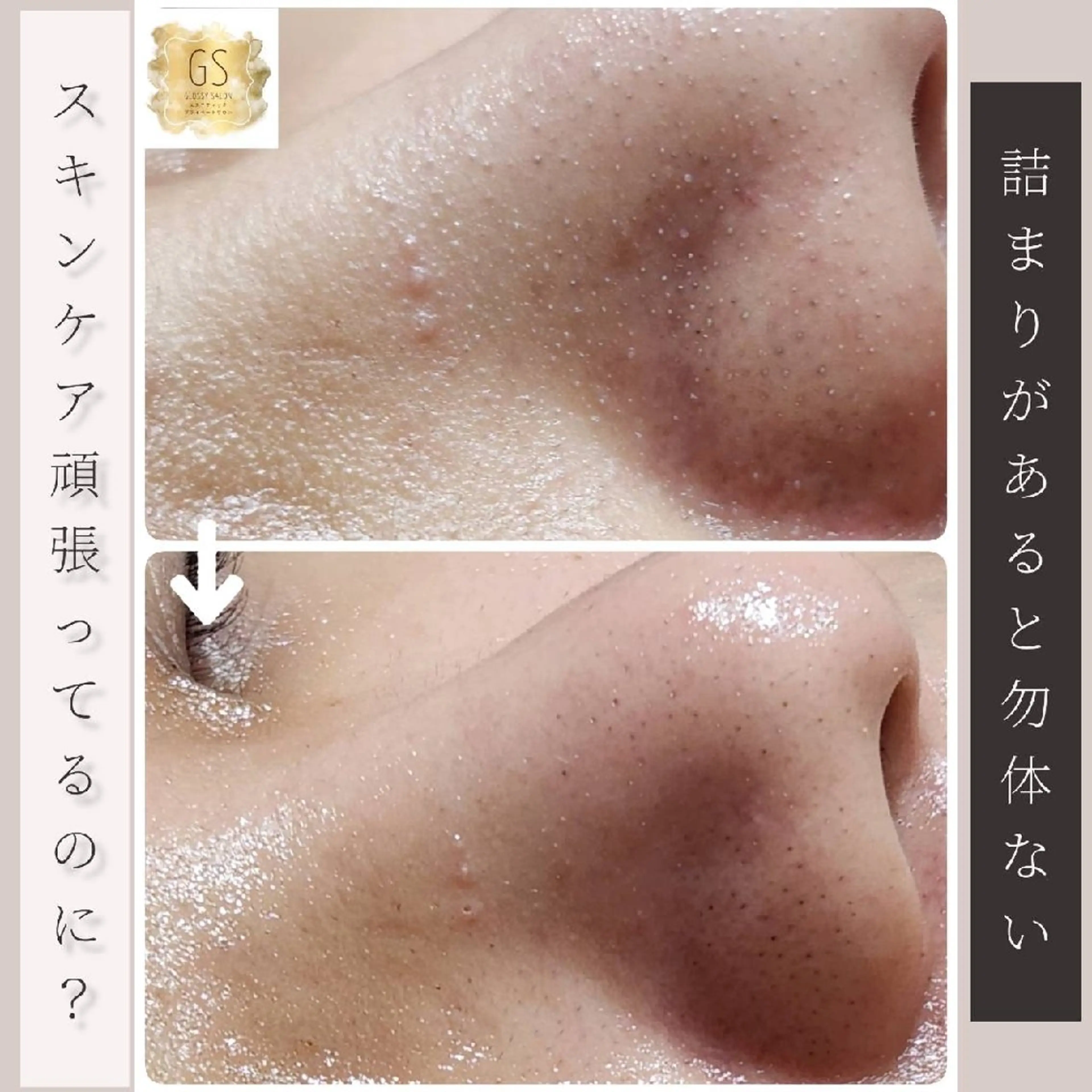 エステ リラク Glossy salonのエステ・リラクイメージ