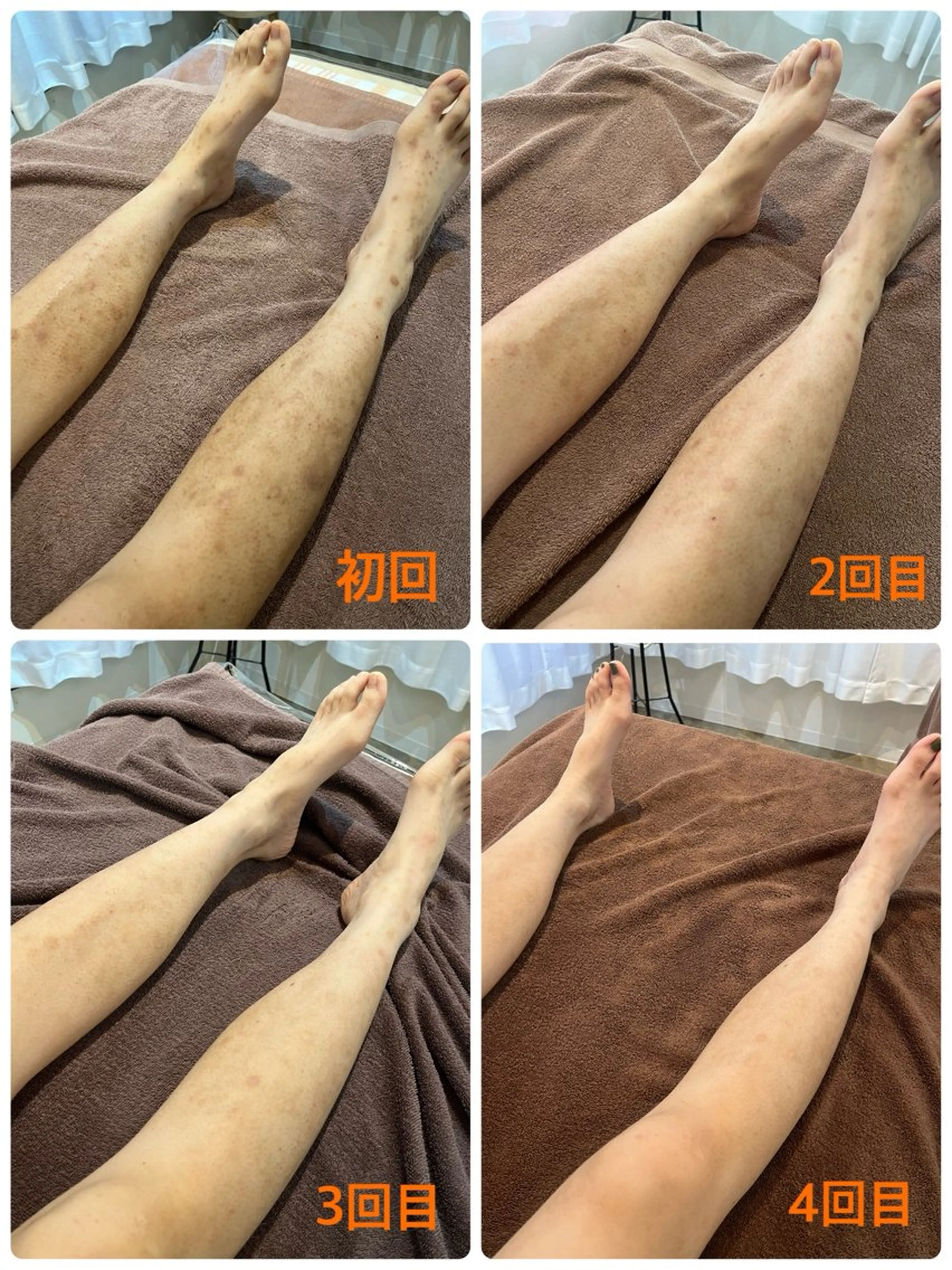 バストアップ・痩身 脱毛/🌺コオリナのエステ・リラクイメージ