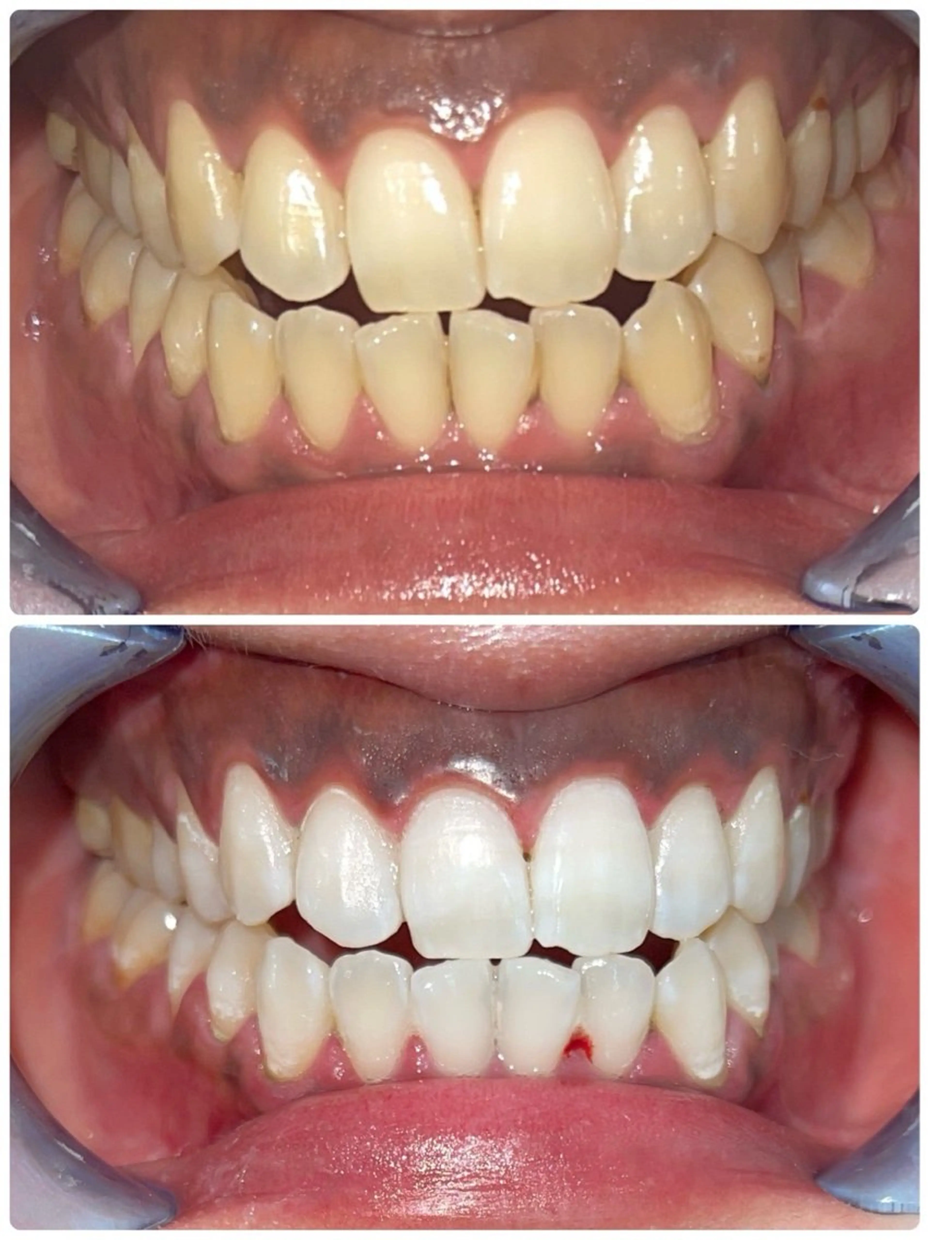 セルフホワイトニング エクシア徳島店マユのその他イメージ