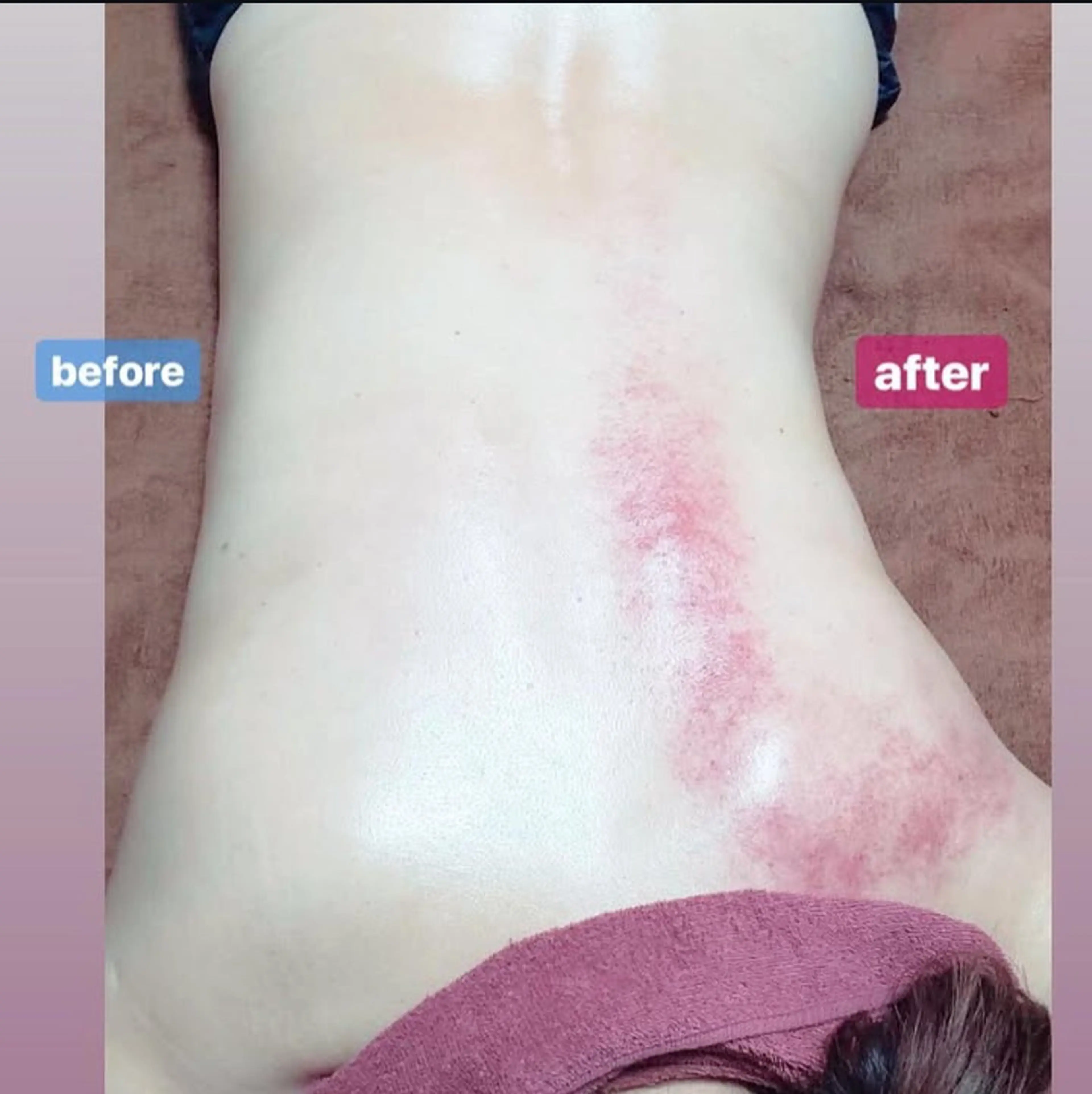 気になる部分集中キャビかけ放題＋痩身計50分の写真