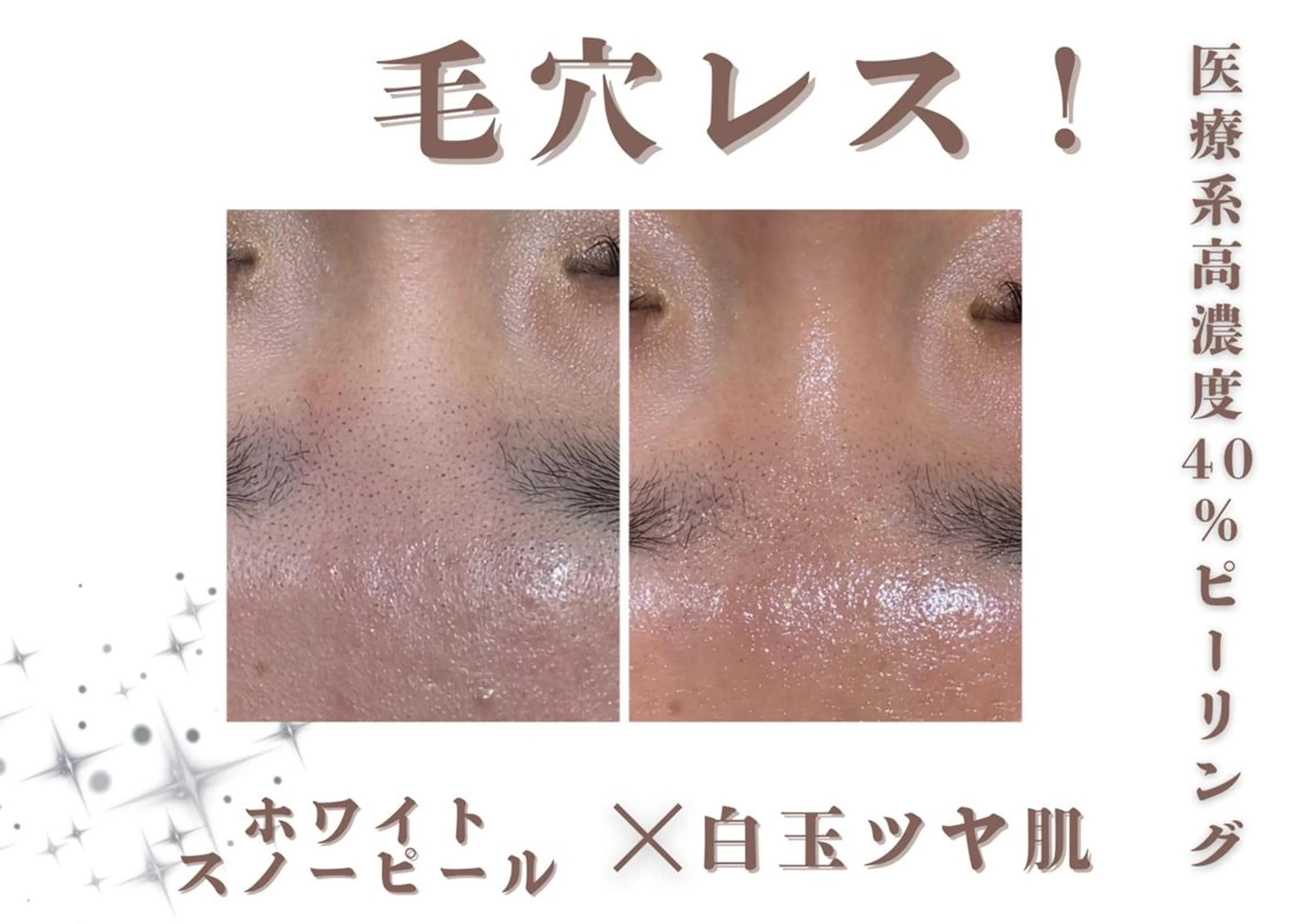 エステ 創業40周年✨美肌サ ロンRAYVIS銀座のエステ・リラクイメージ