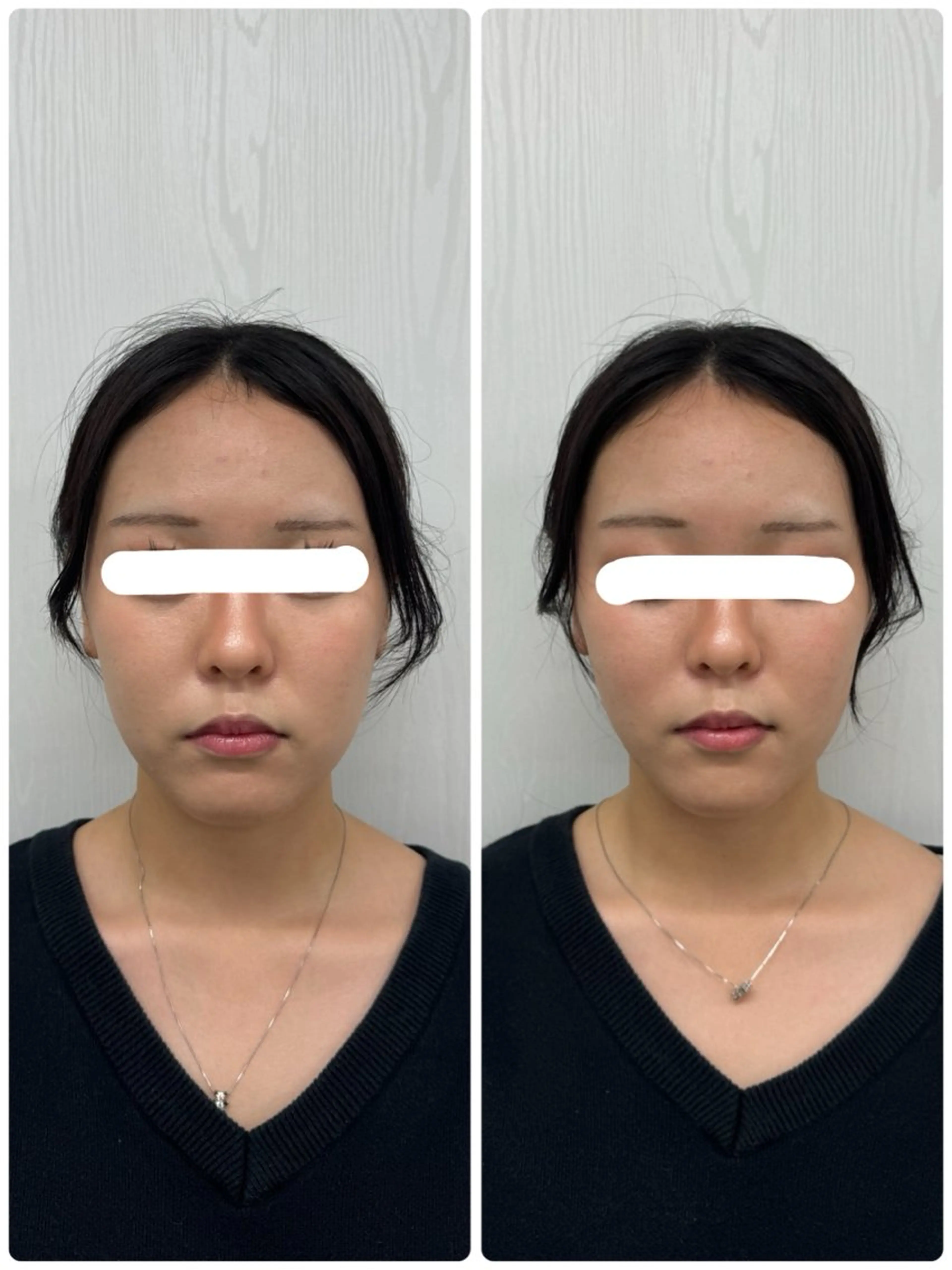 エステ リラク 美容鍼×小顔矯正 ×美容整体　浜川泰仁のエステ・リラクイメージ