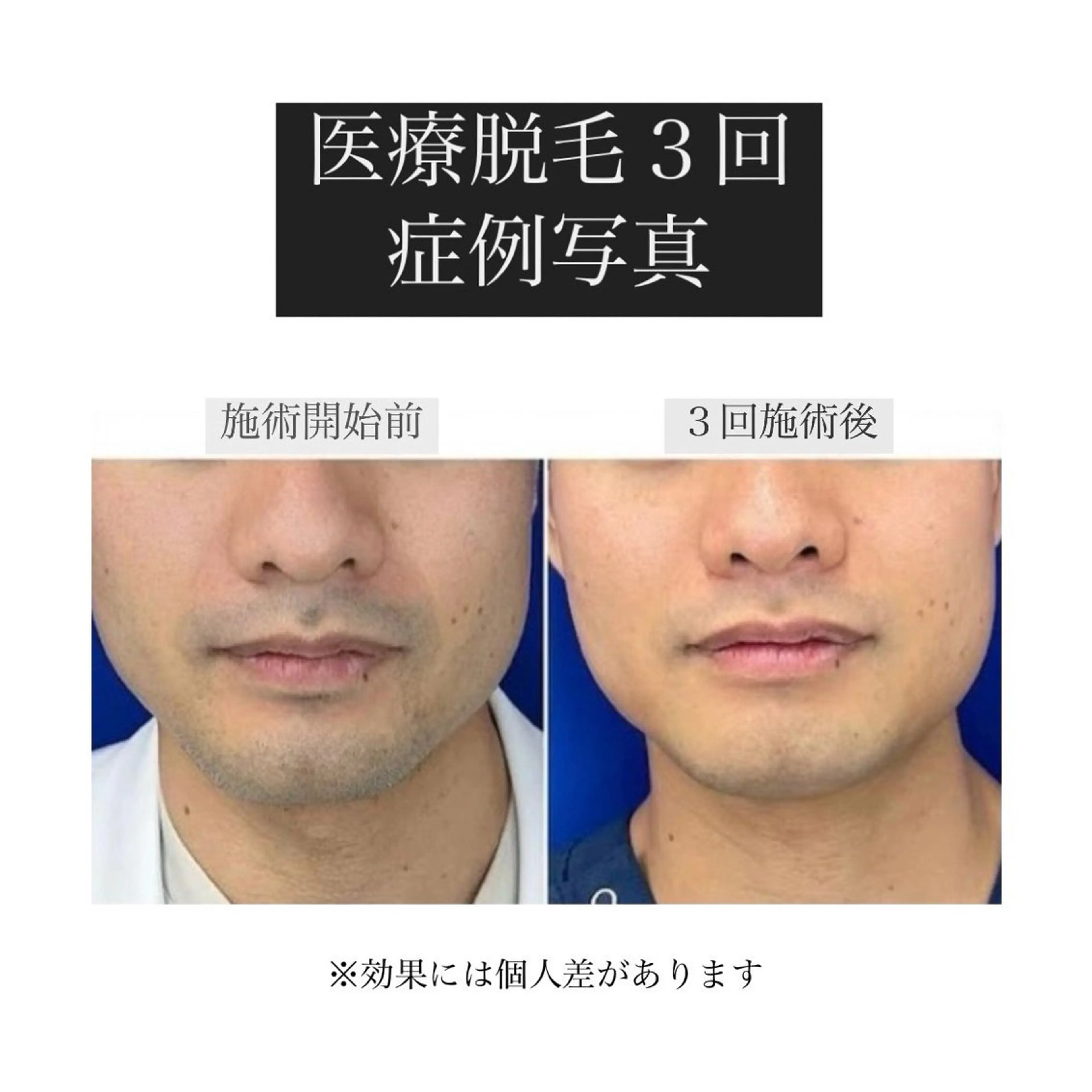 BITSU　PRESS原宿所属・PRESS 中山のエステ・リラクイメージ