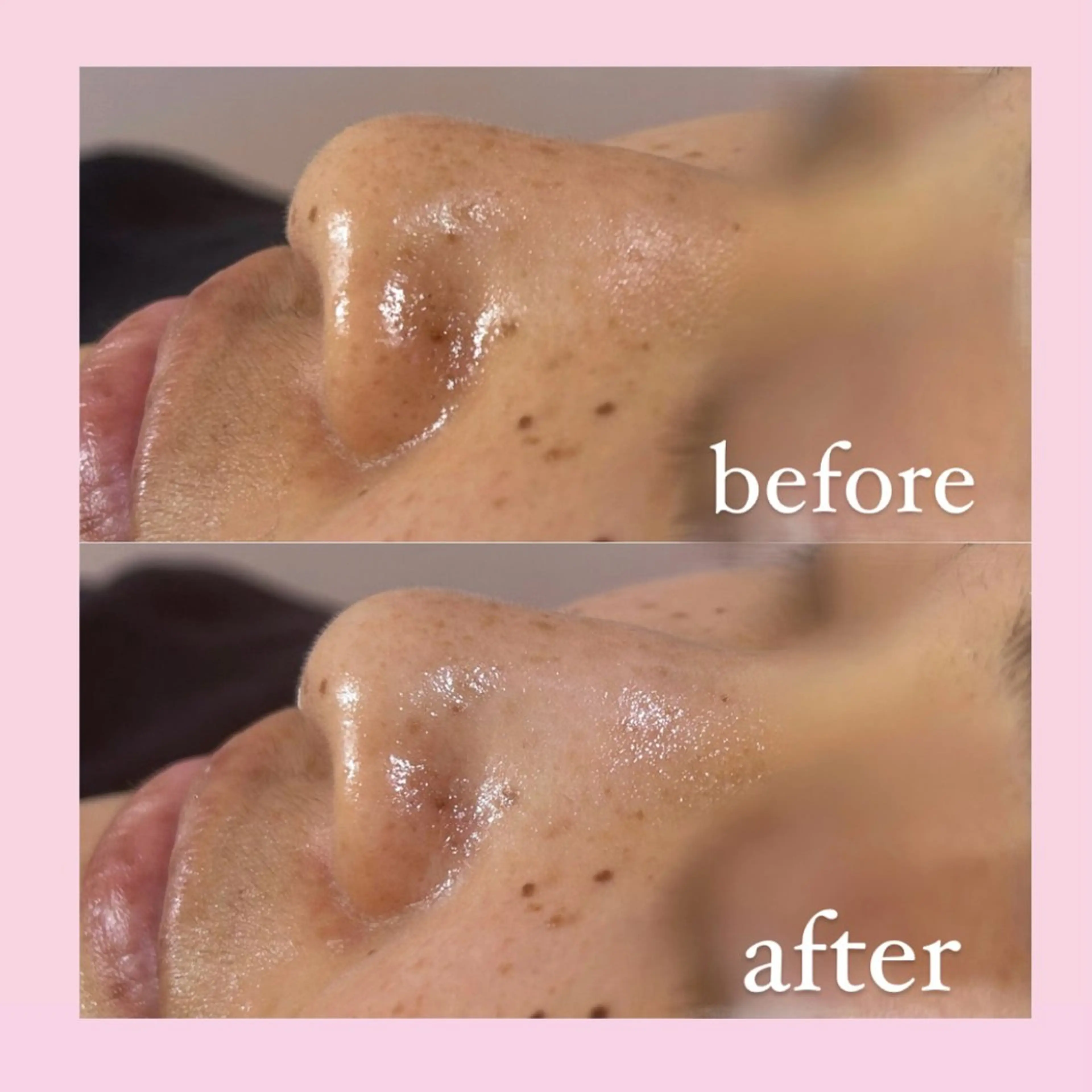 エステ 韓国肌管理専門店　White labo 宝塚店所属・有川 凜のエステ・リラクイメージ