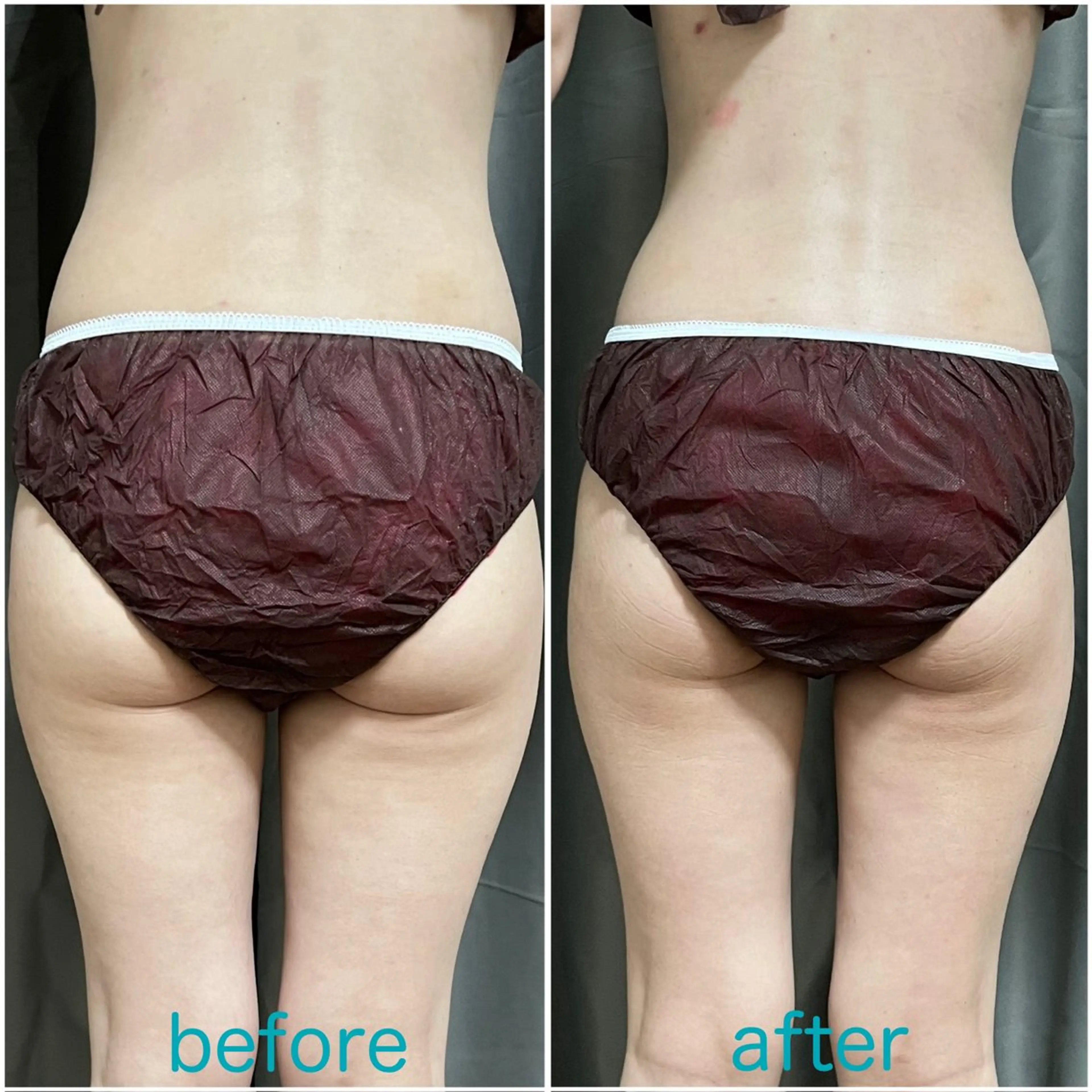 Loar 【痩身/小顔エステサロン】所属・Loar エステ中野 絵里奈のエステ・リラクイメージ