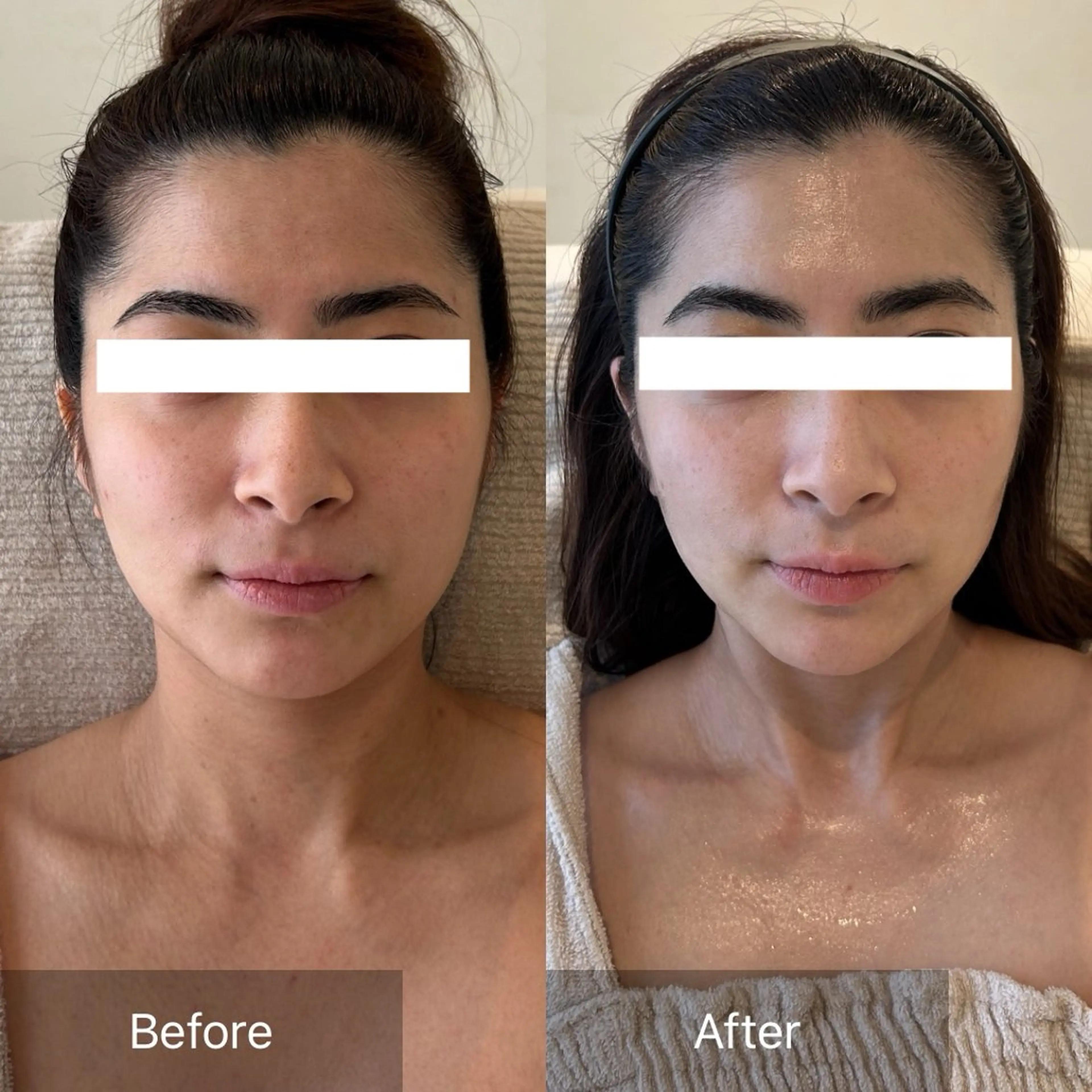 エステ Charis エステ&ネイルのエステ・リラクイメージ