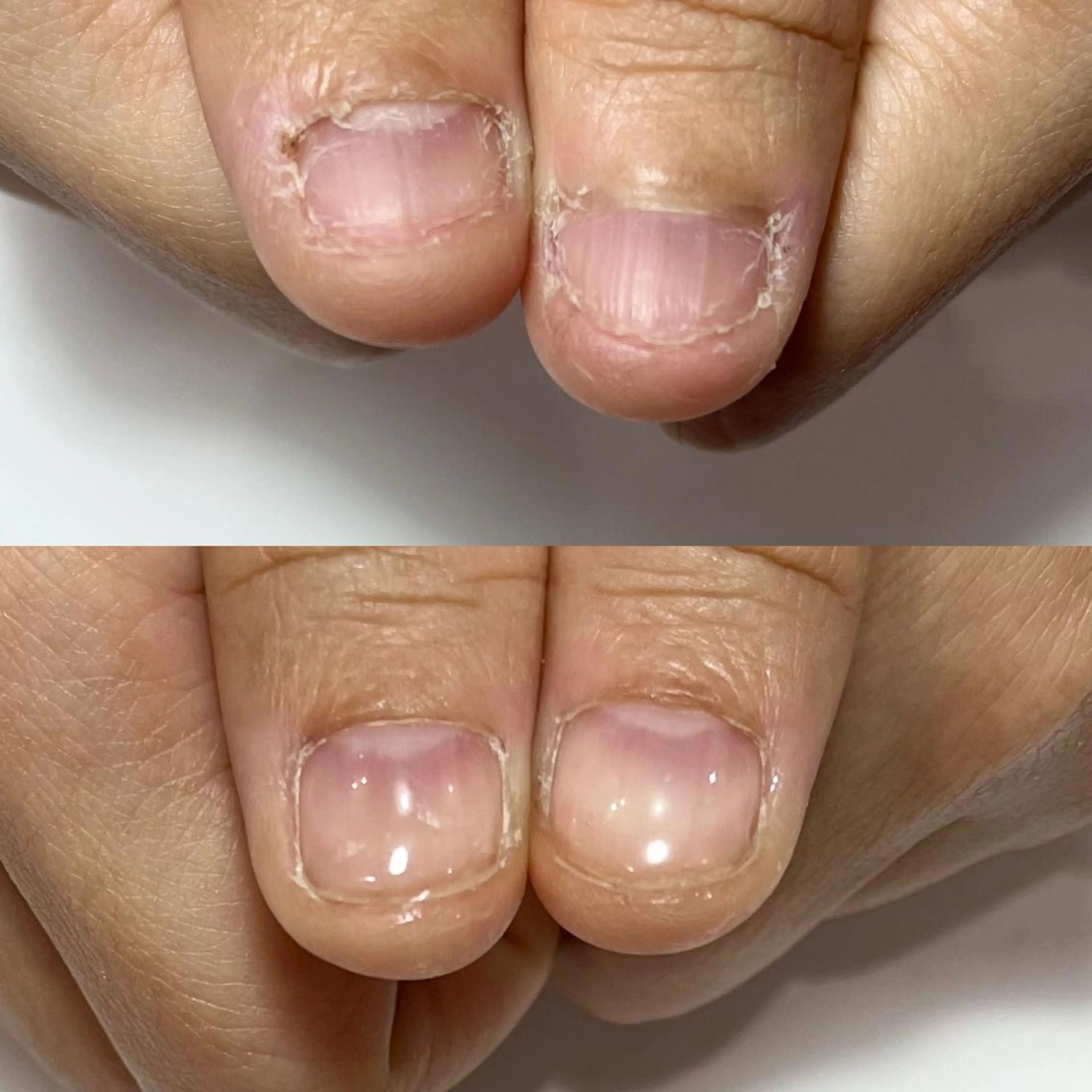 ネイル 自爪育成・巻き爪 補正講師　津蔵のネイルデザイン